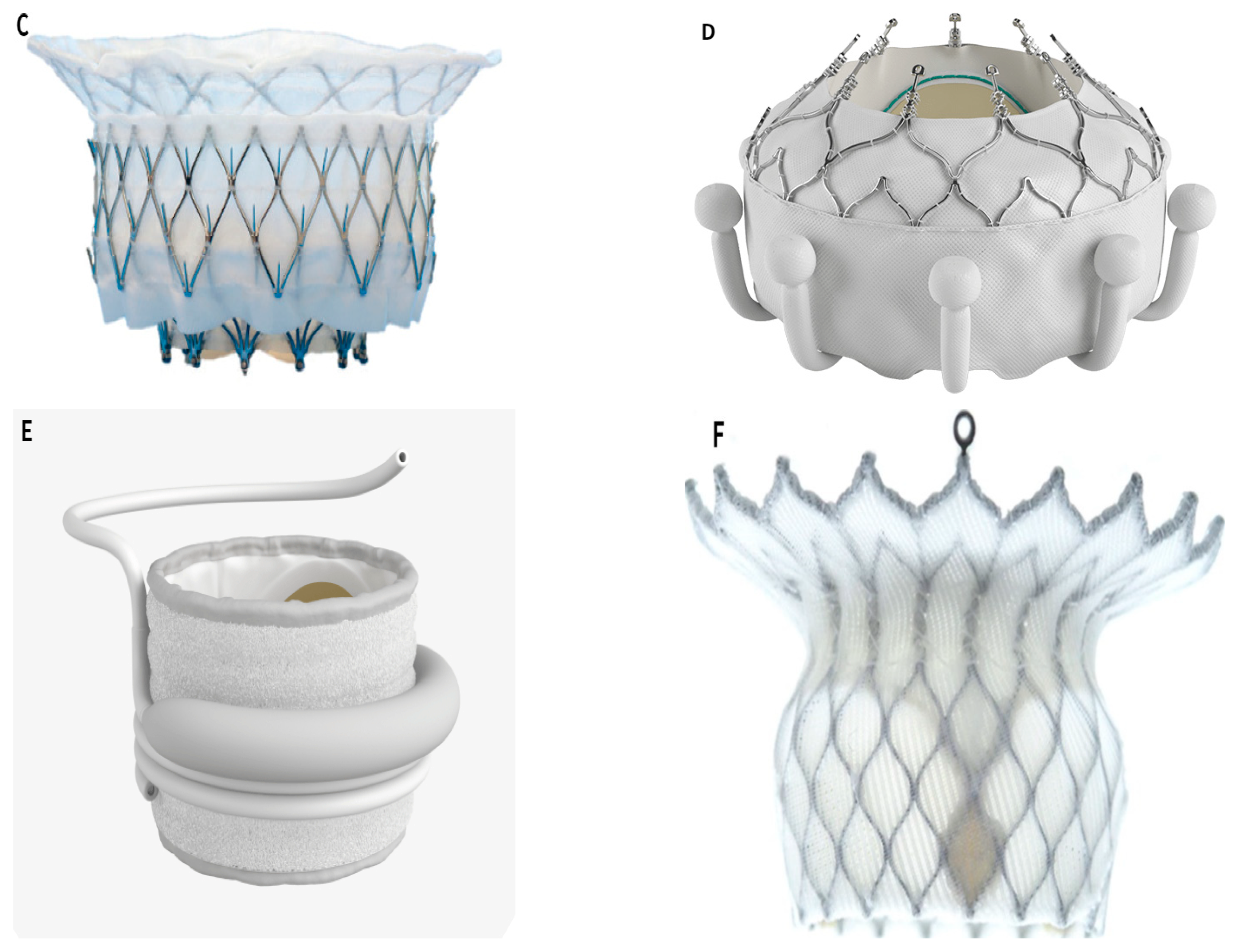 【2024】三越のお歳暮・冬ギフト Transcatheter Replacement or Repair Valve Mitral トップス
