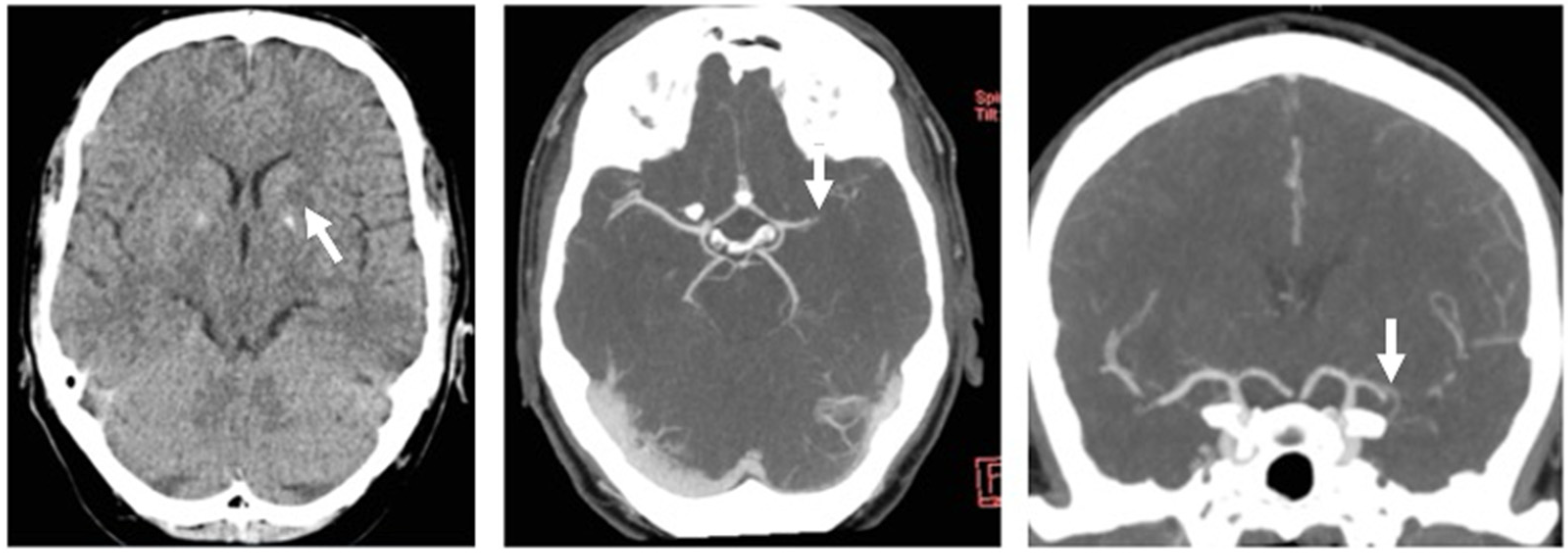 Jcm 11 03384 g001 Jcm 11 03384 g001