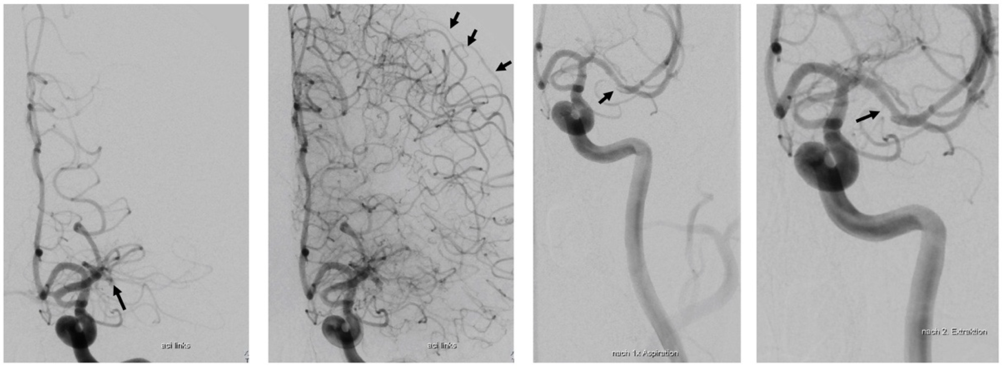 Jcm 11 03384 g002 Jcm 11 03384 g002