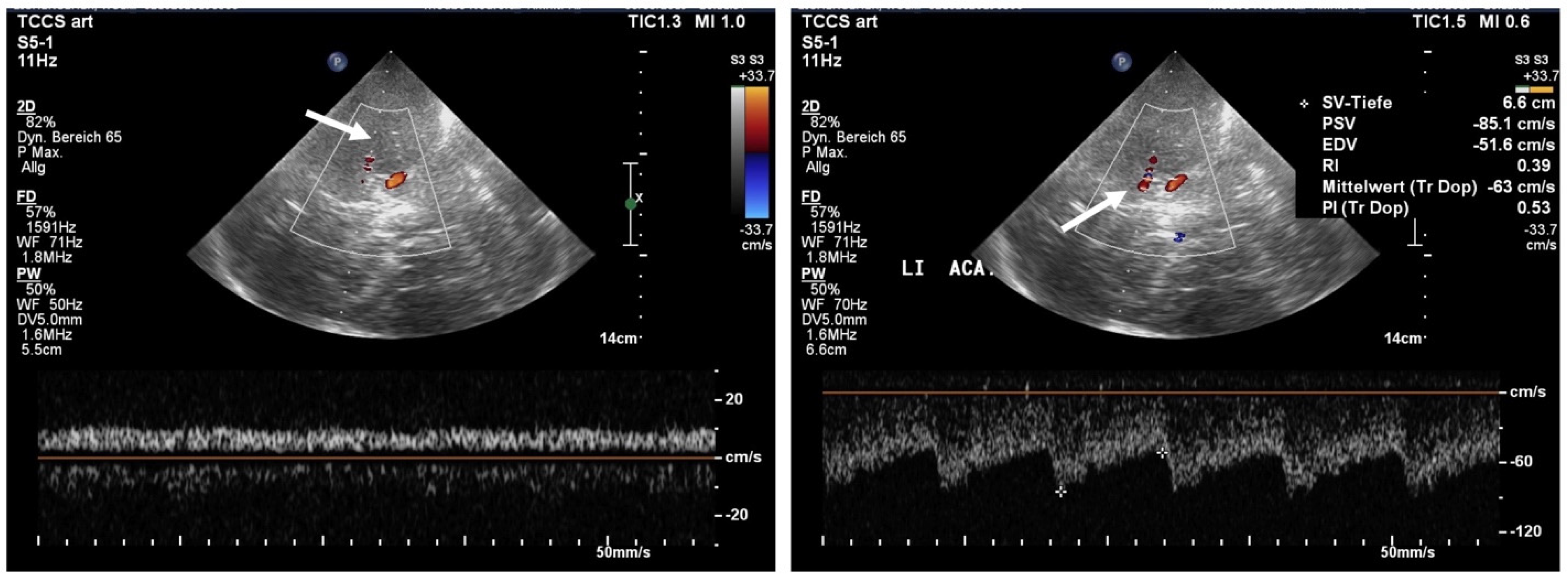Jcm 11 03384 g005 Jcm 11 03384 g005