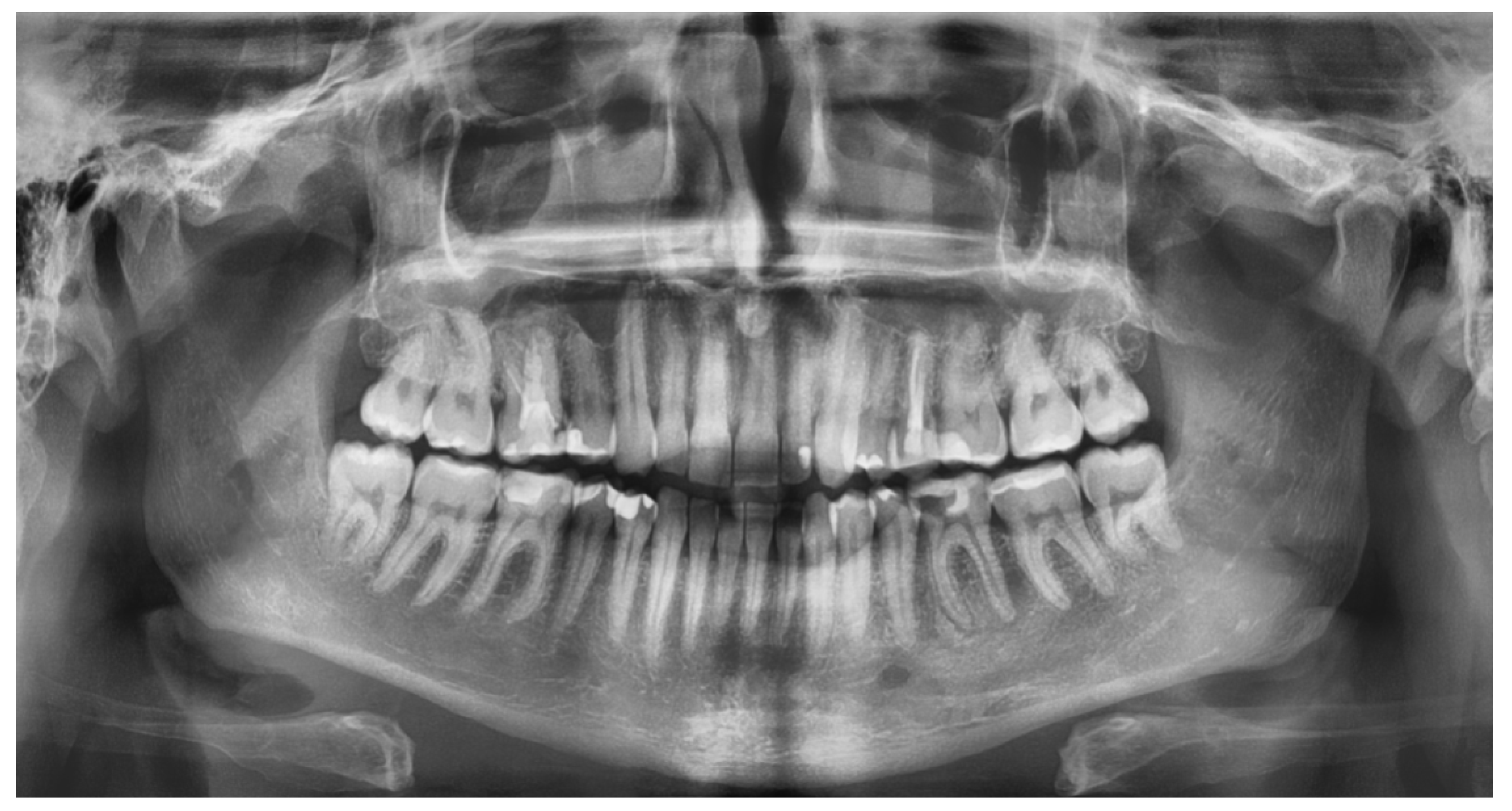 Jcm 11 03391 g001 Jcm 11 03391 g001