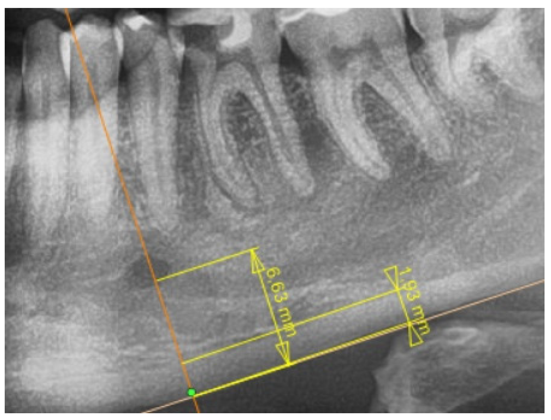 Jcm 11 03391 g002 Jcm 11 03391 g002