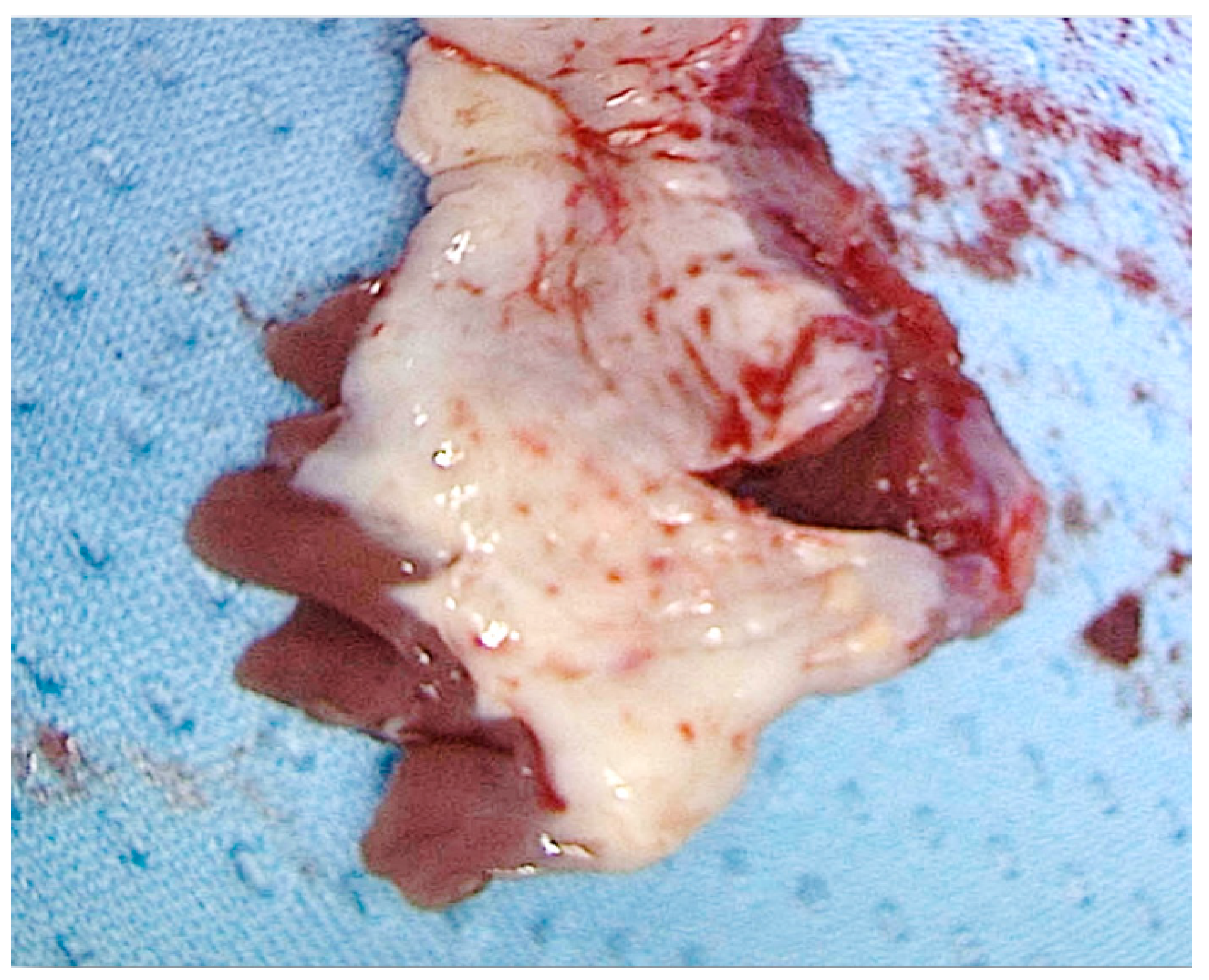 Jcm 11 03405 g003 Jcm 11 03405 g003