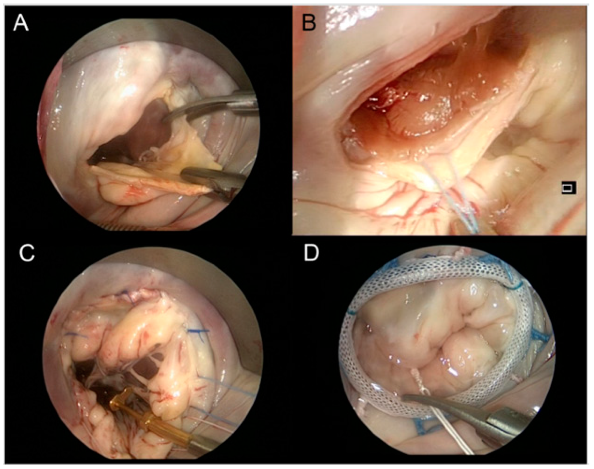 Jcm 11 03405 g005 Jcm 11 03405 g005