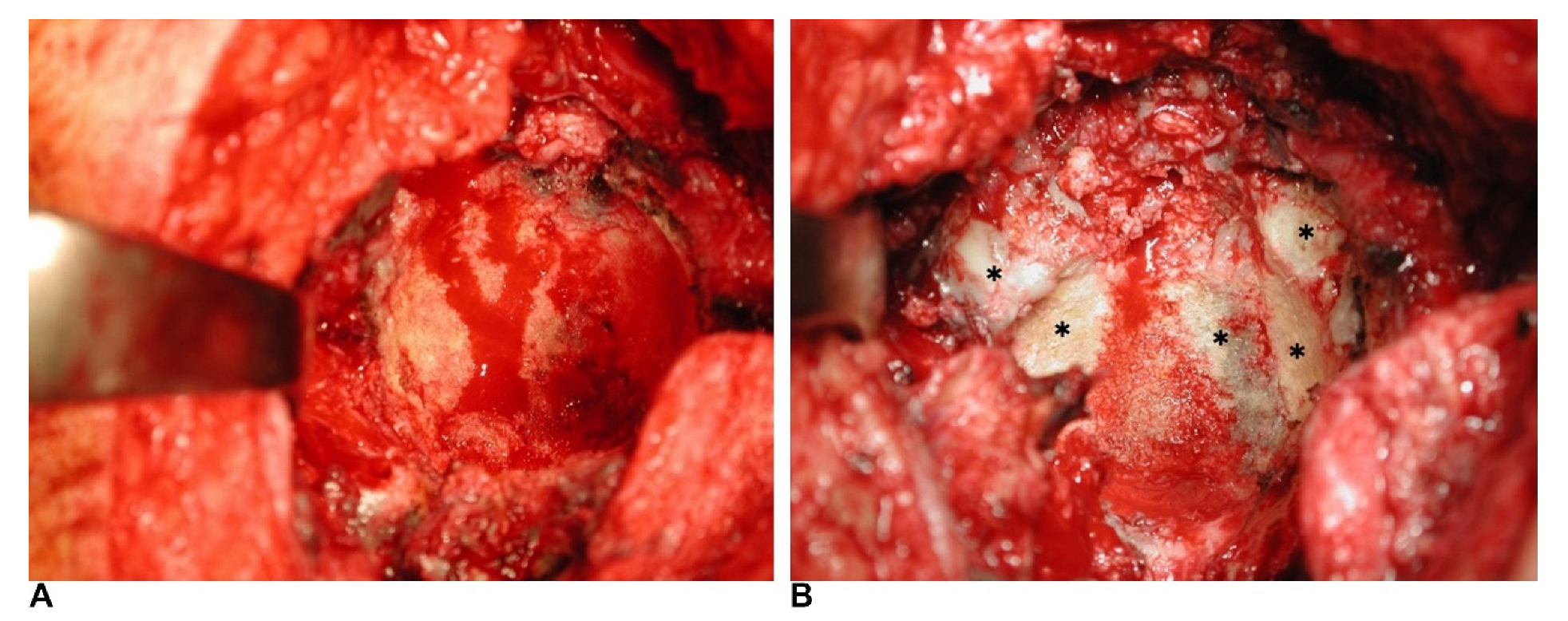 Jcm 11 03428 g001 Jcm 11 03428 g001