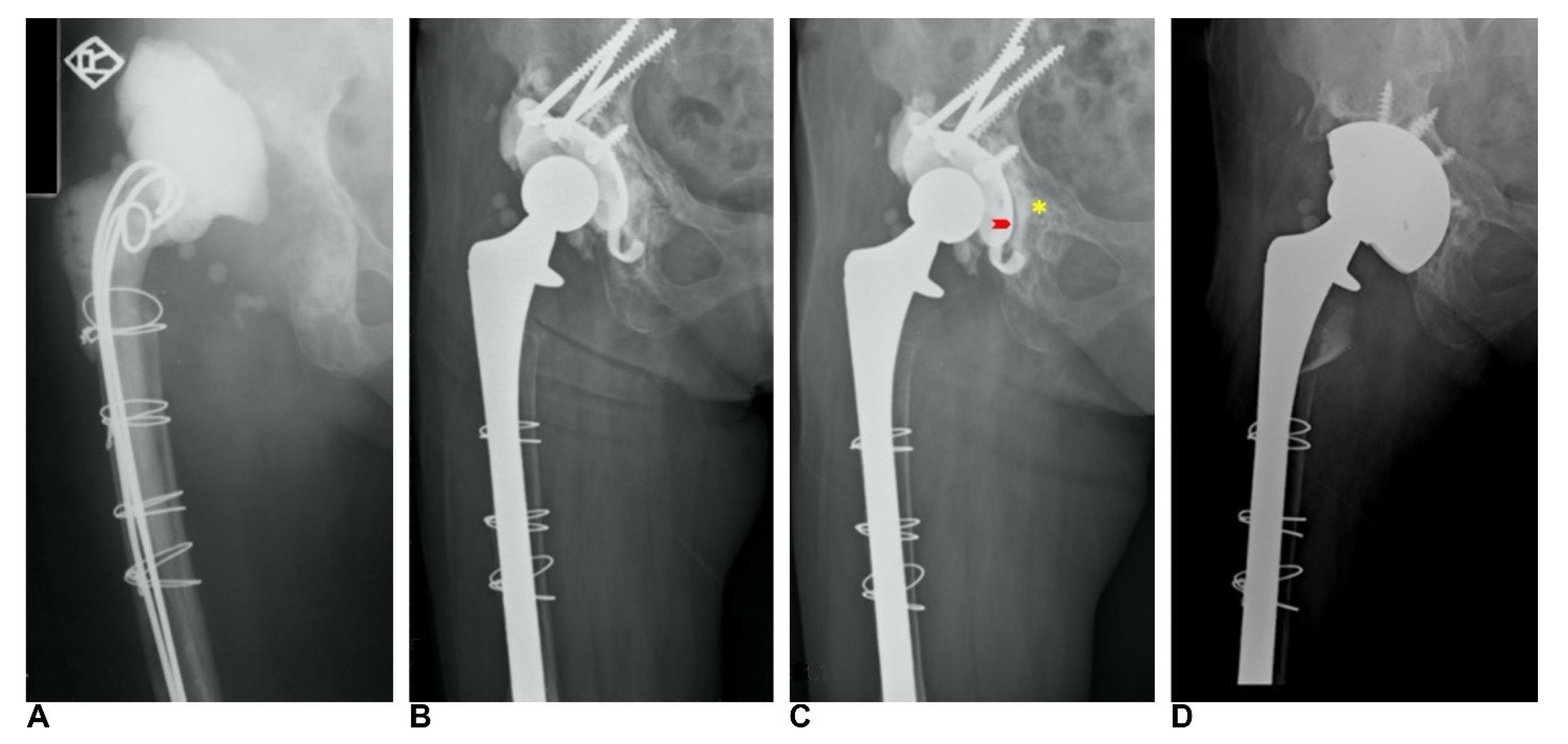Jcm 11 03428 g003 Jcm 11 03428 g003