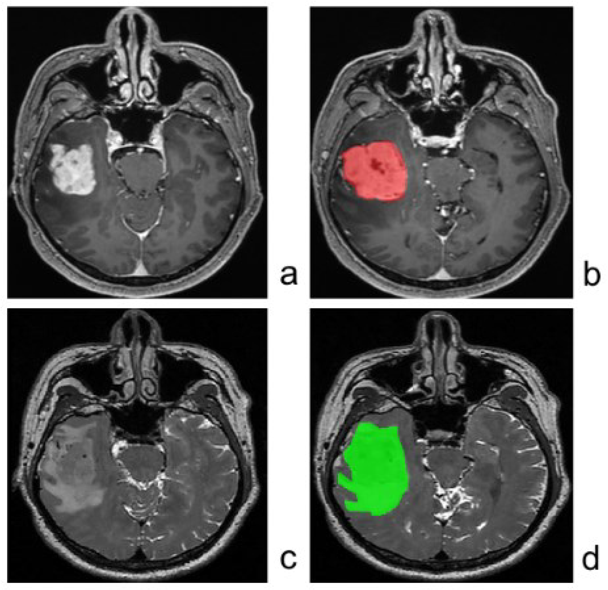 Jcm 11 03445 g002 550