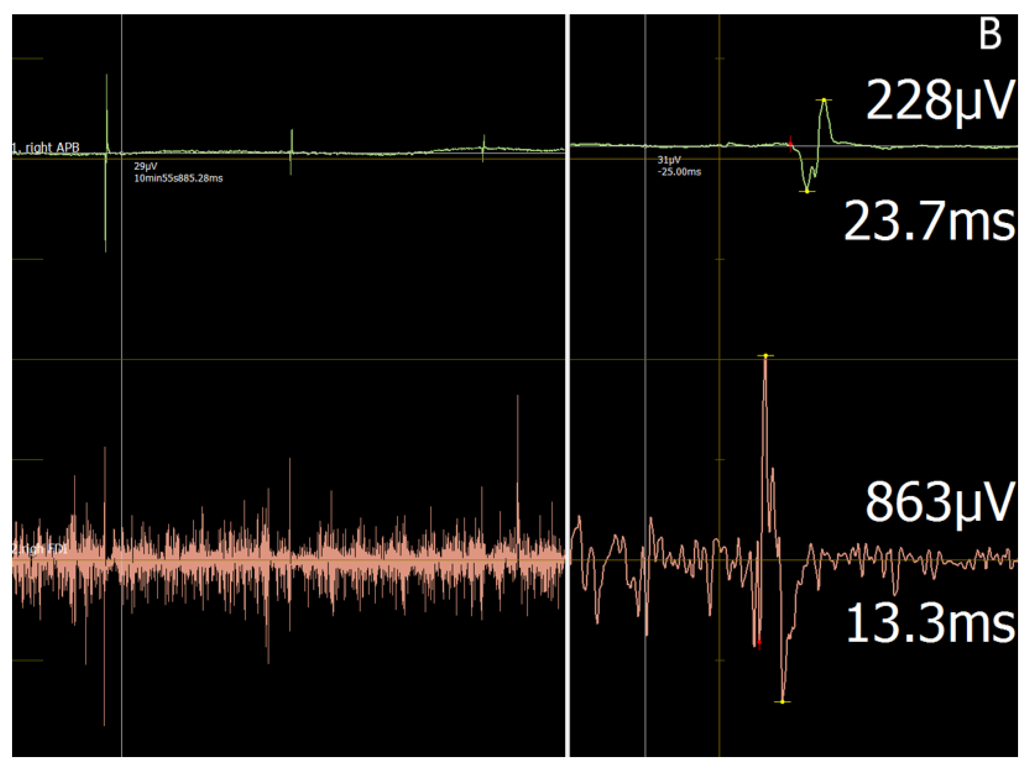 Jcm 11 03453 g001b 550