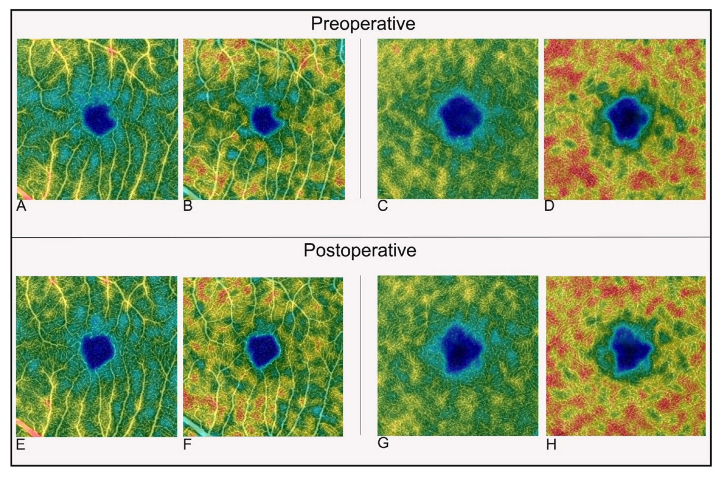 Jcm 11 03498 g002 550