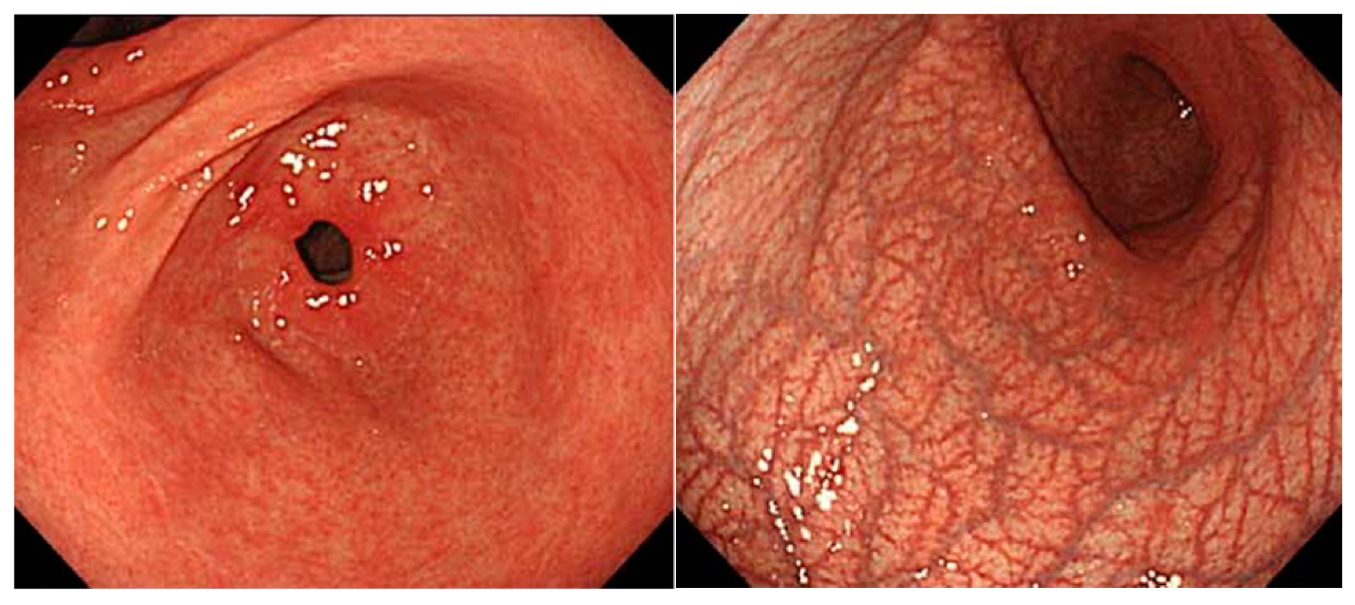 Jcm 11 03523 g002 550