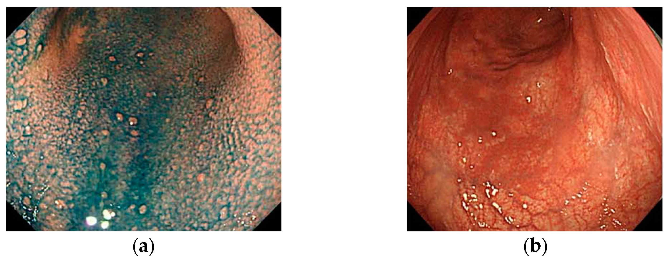 Jcm 11 03523 g003 550