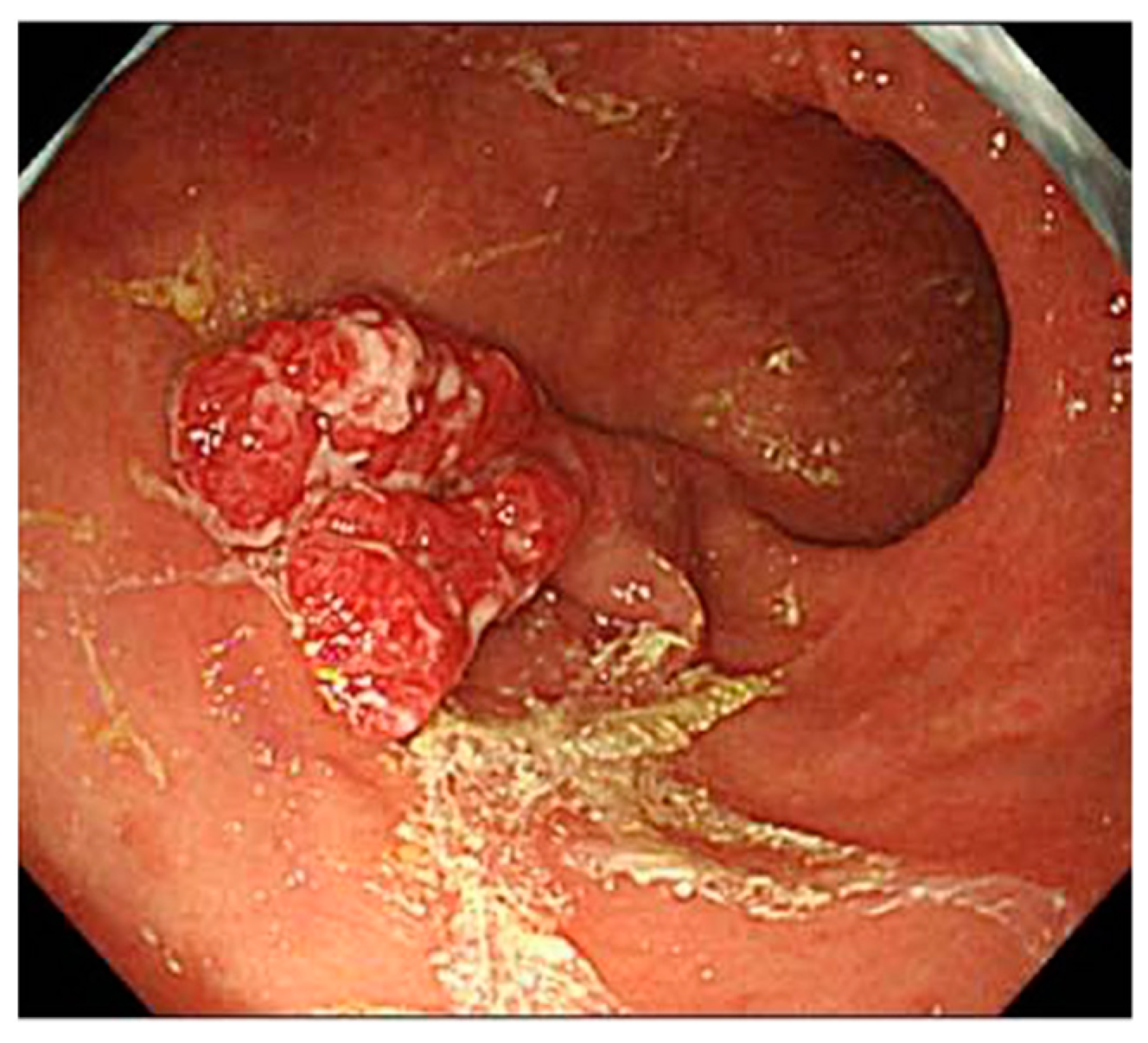 Jcm 11 03523 g004 550