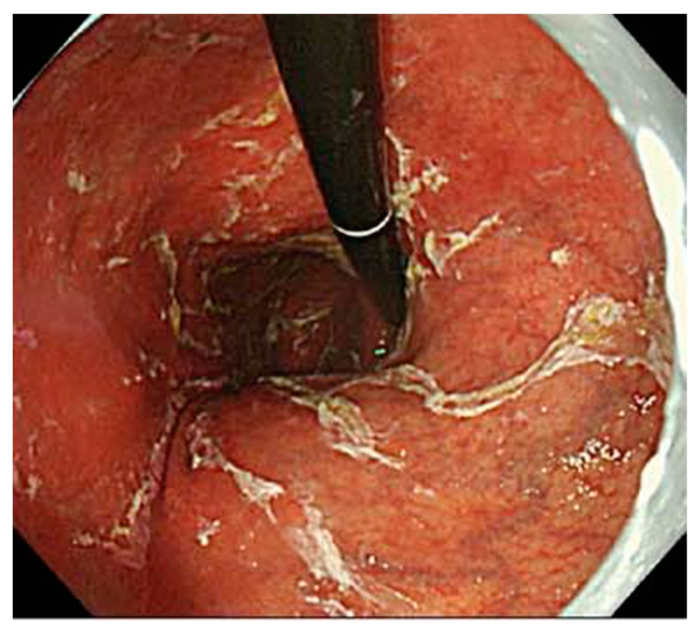 Jcm 11 03523 g005 550