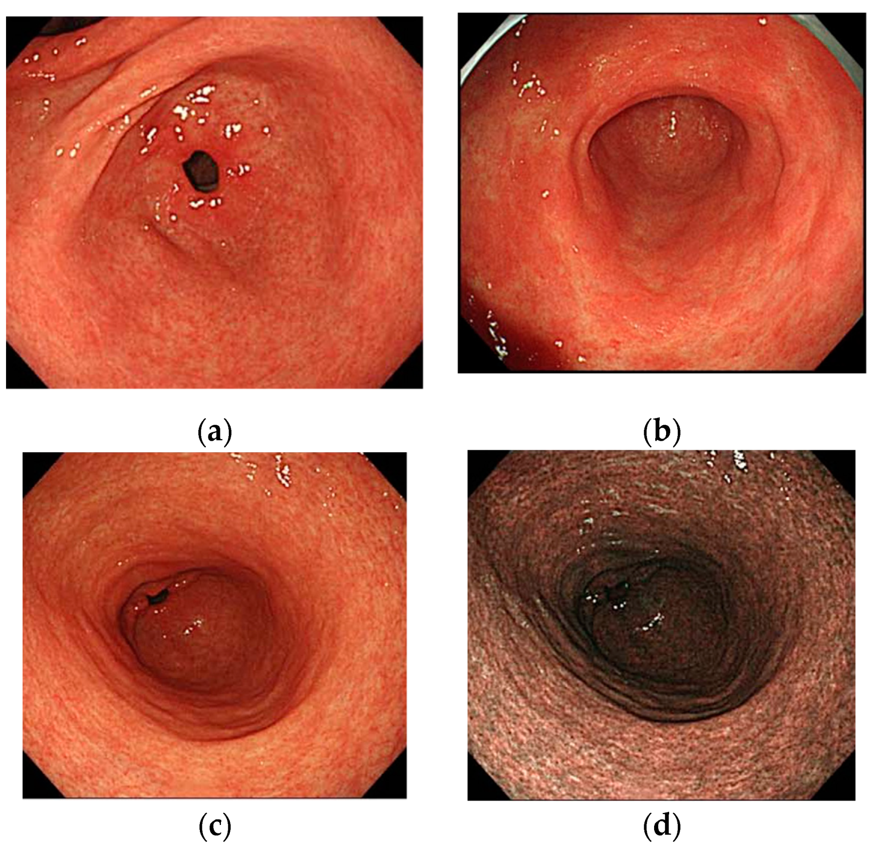 Jcm 11 03523 g006 550