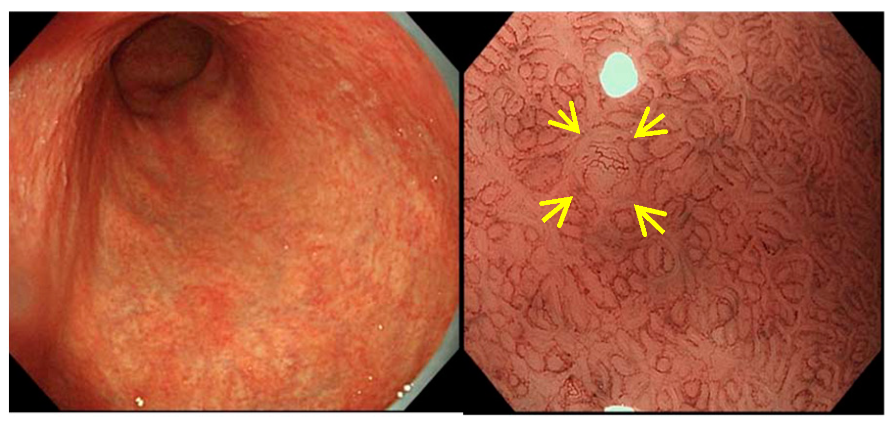 Jcm 11 03523 g009 550