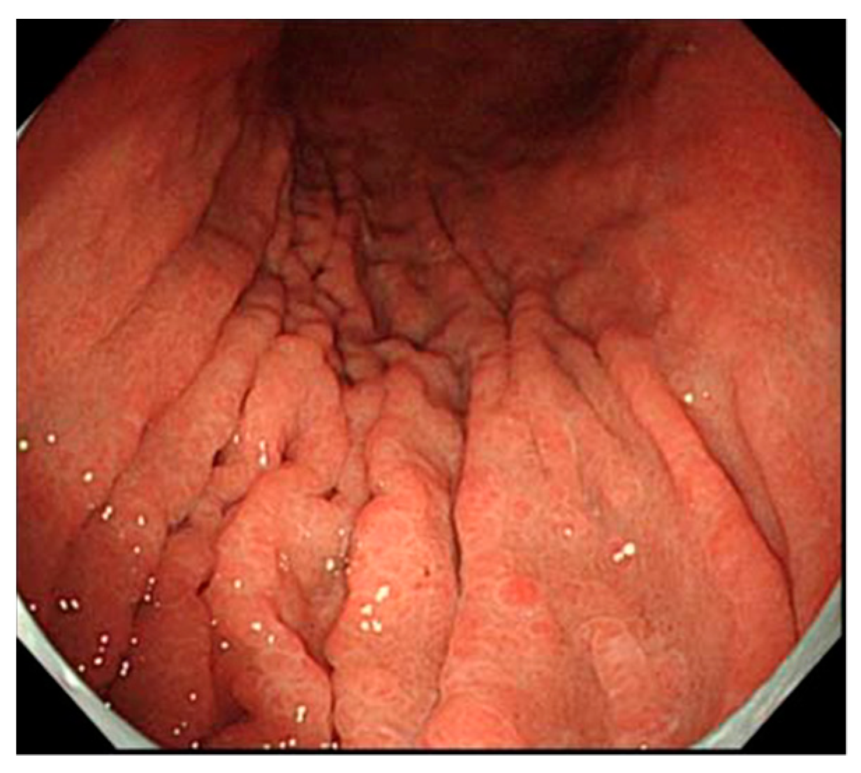 Jcm 11 03523 g011 550