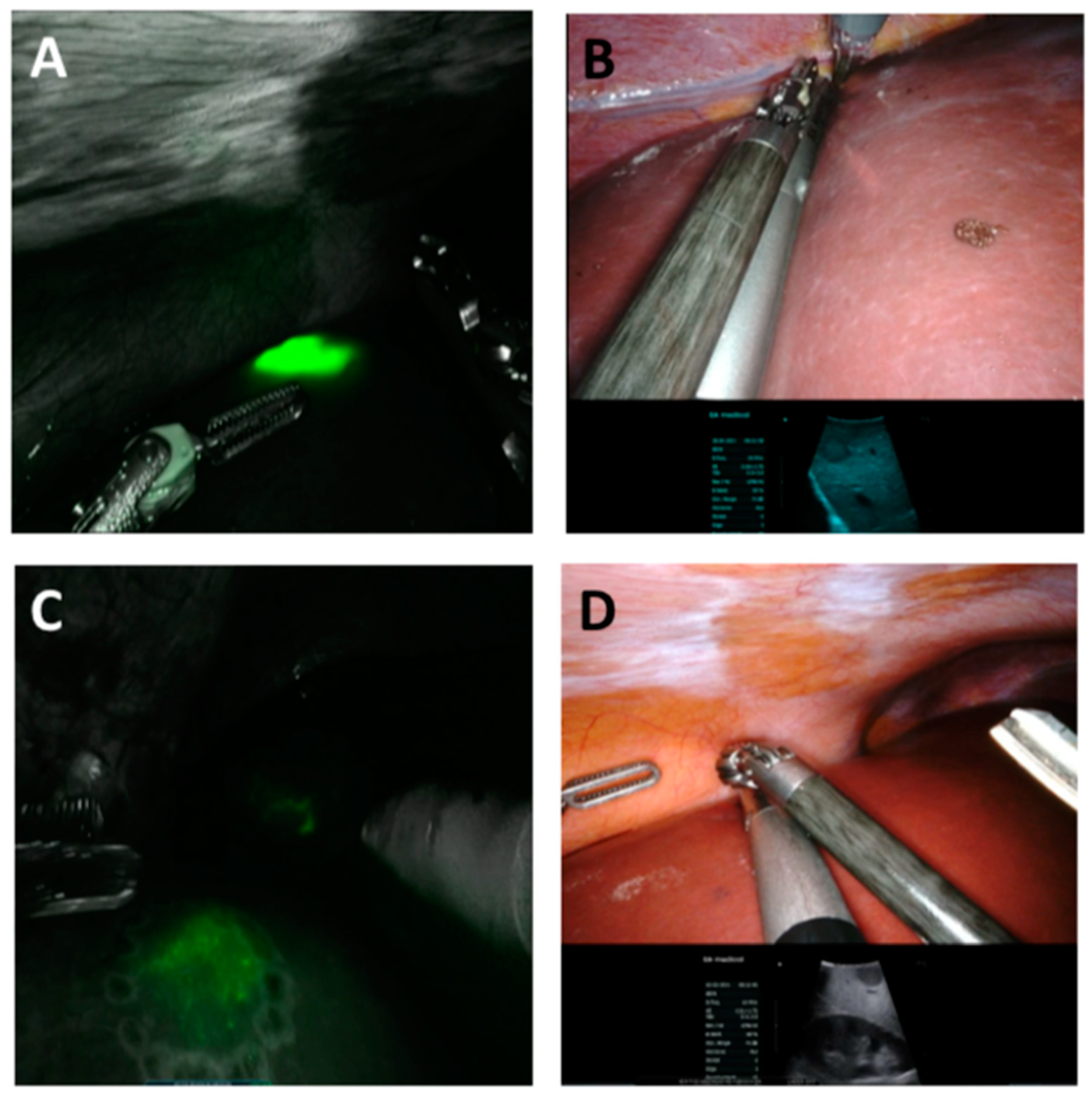 Jcm 11 03527 g002 550