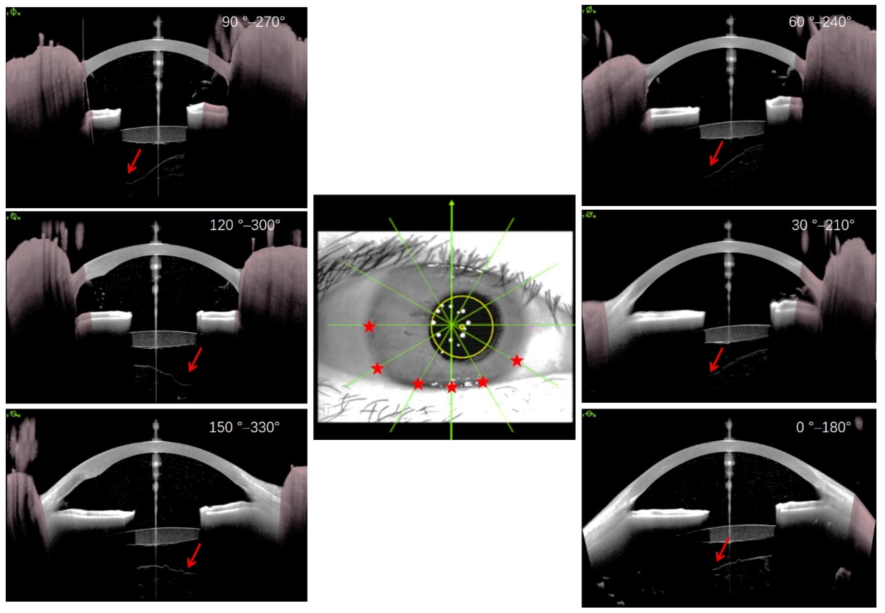 Jcm 11 03580 g004 550