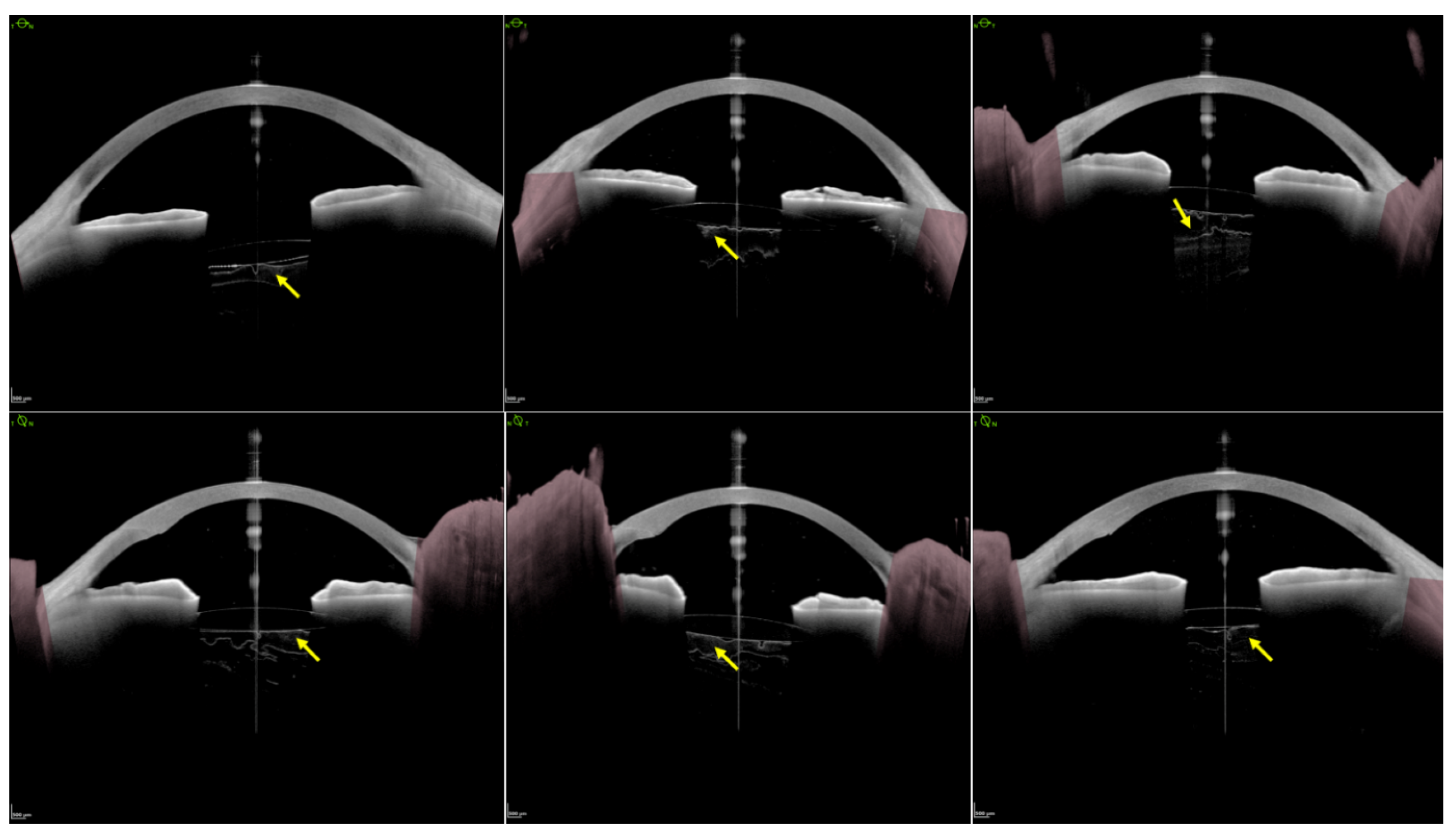 Jcm 11 03580 g005 550