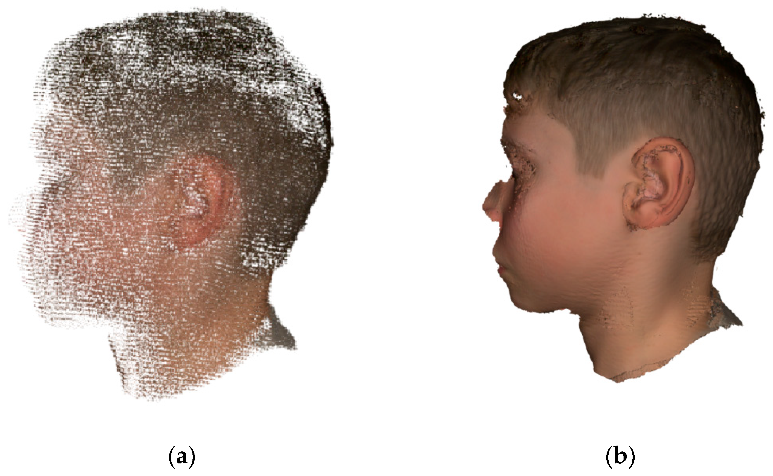 JCM | Free Full-Text | Microtia Ear Reconstruction with Patient-Specific 3D Models&mdash;A Segmentation Protocol | HTML