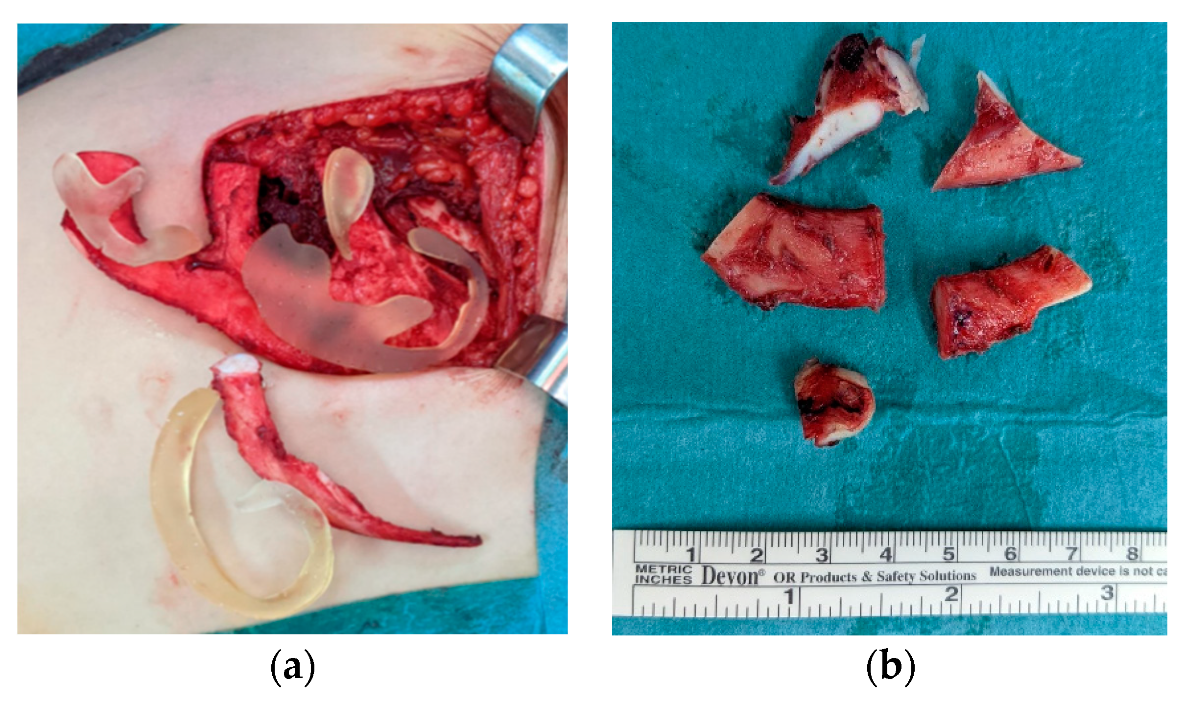 Jcm 11 03591 g004 Jcm 11 03591 g004