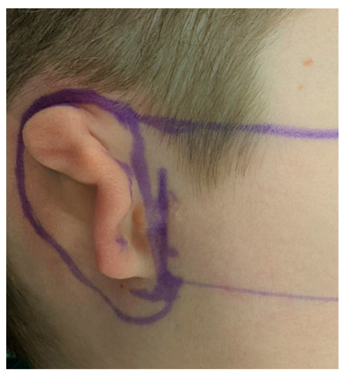 Jcm 11 03591 g005 Jcm 11 03591 g005