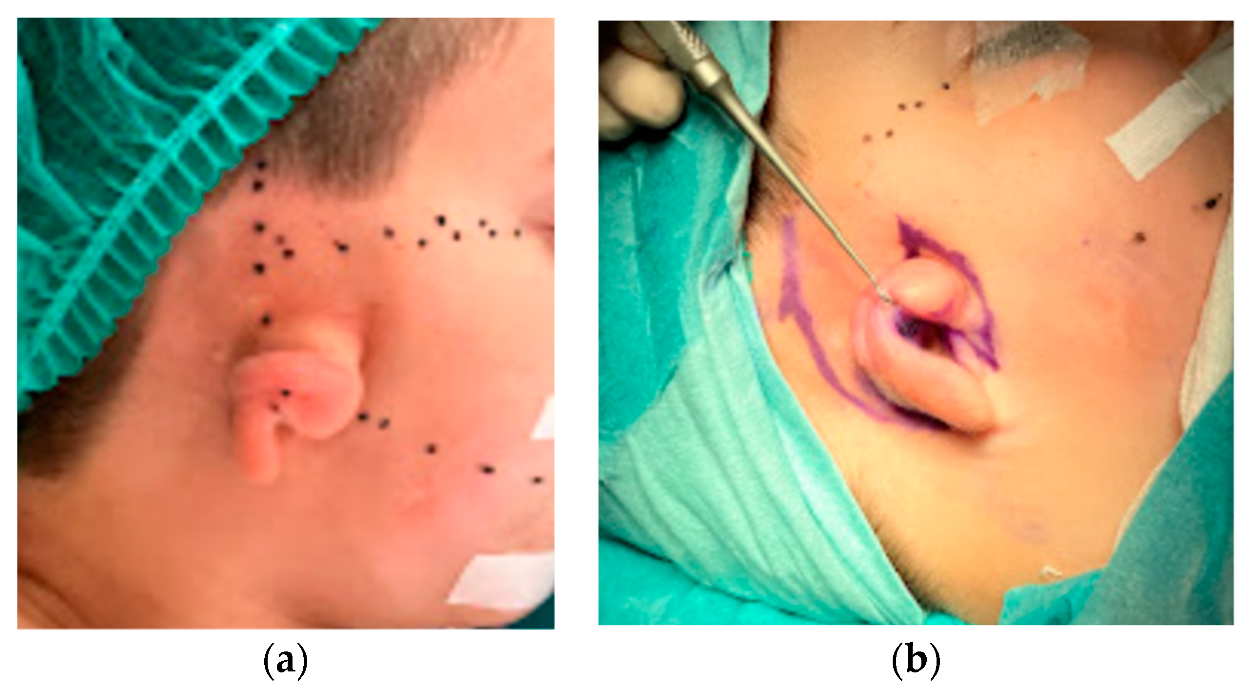 Jcm 11 03591 g008 Jcm 11 03591 g008