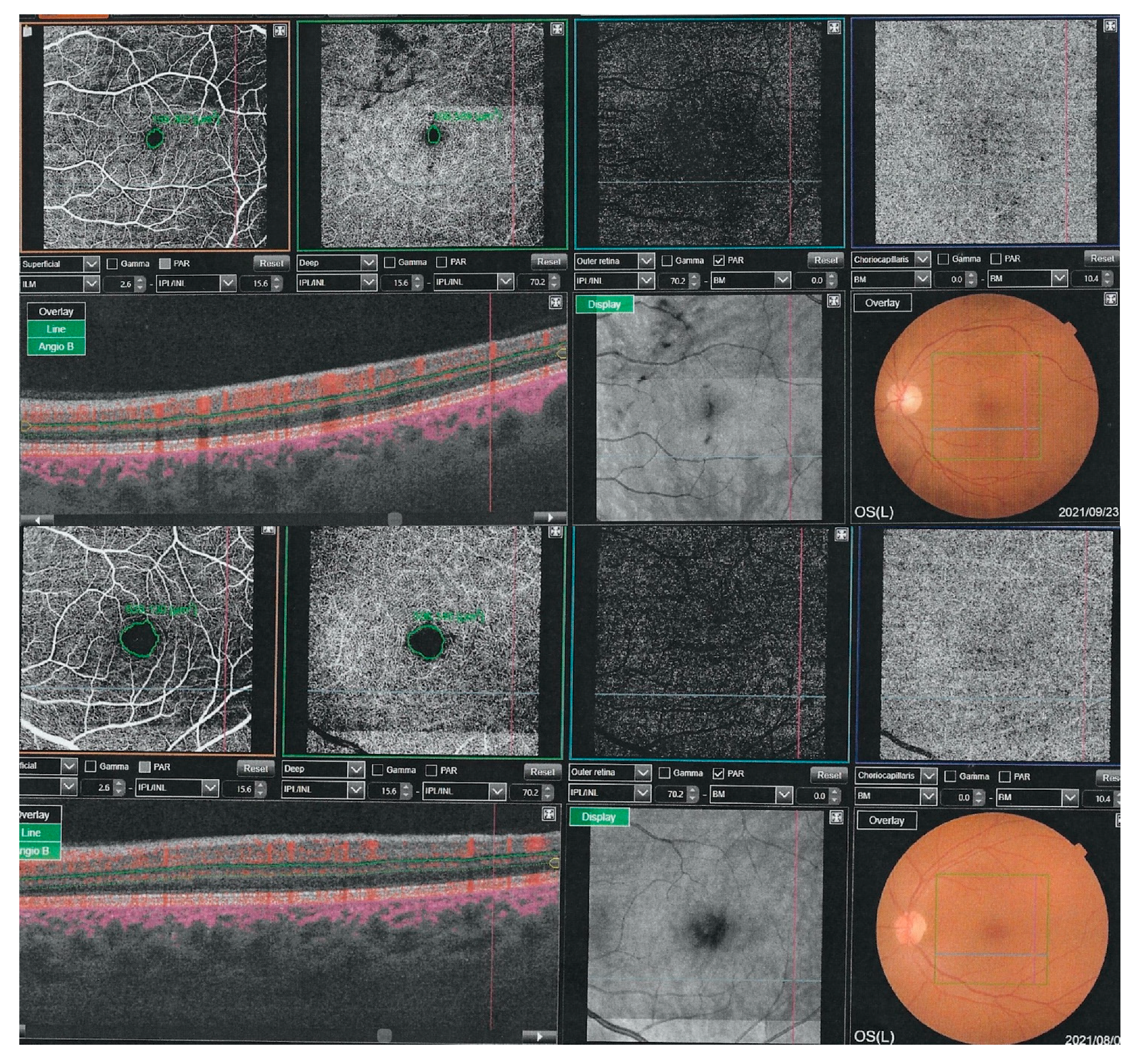 Jcm 11 03621 g002 Jcm 11 03621 g002