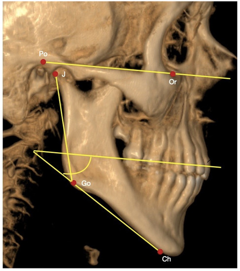 Essential requirements of a non-occlusal mandibu- lar reference position