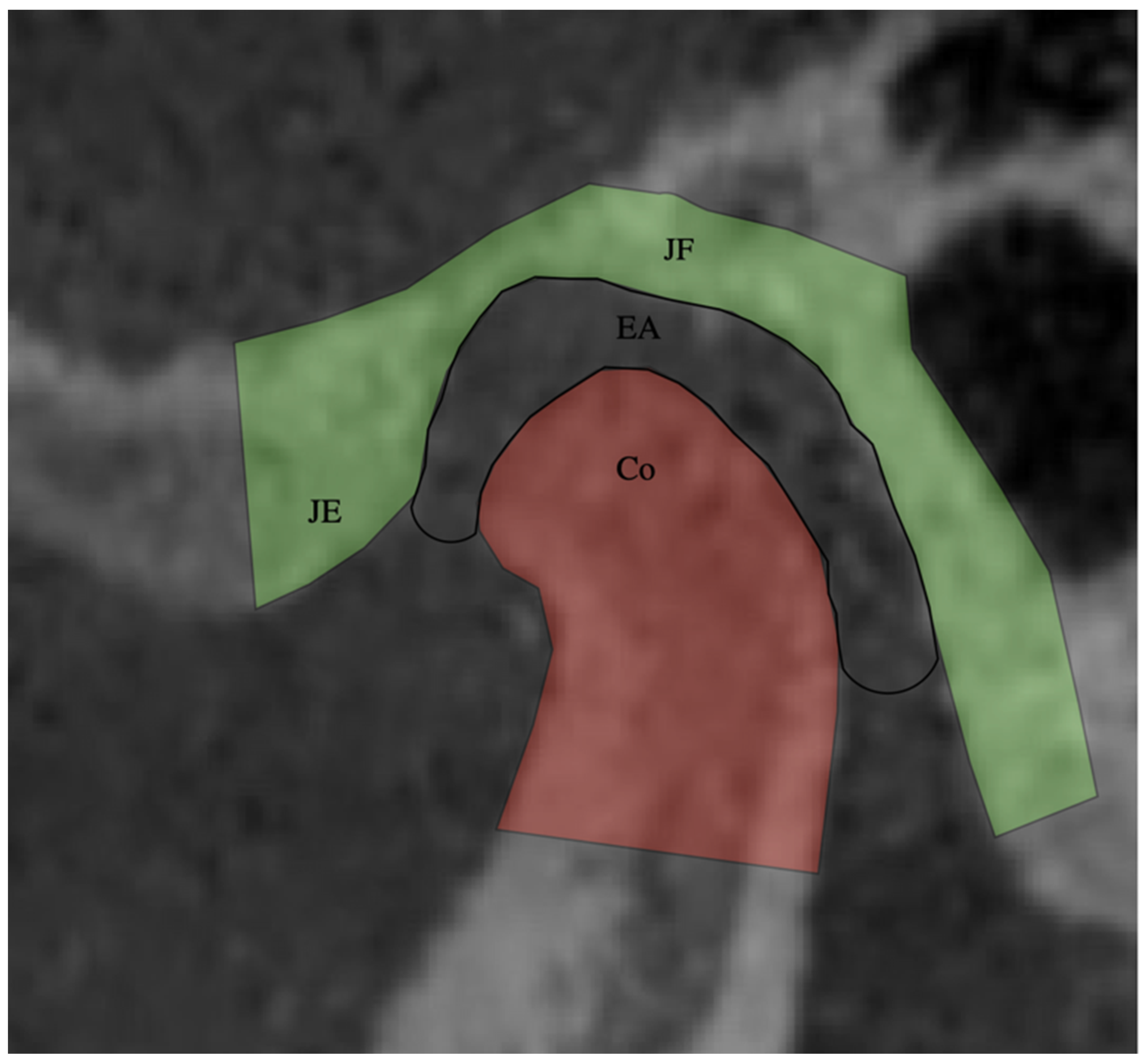 Jcm 11 03631 g002 Jcm 11 03631 g002