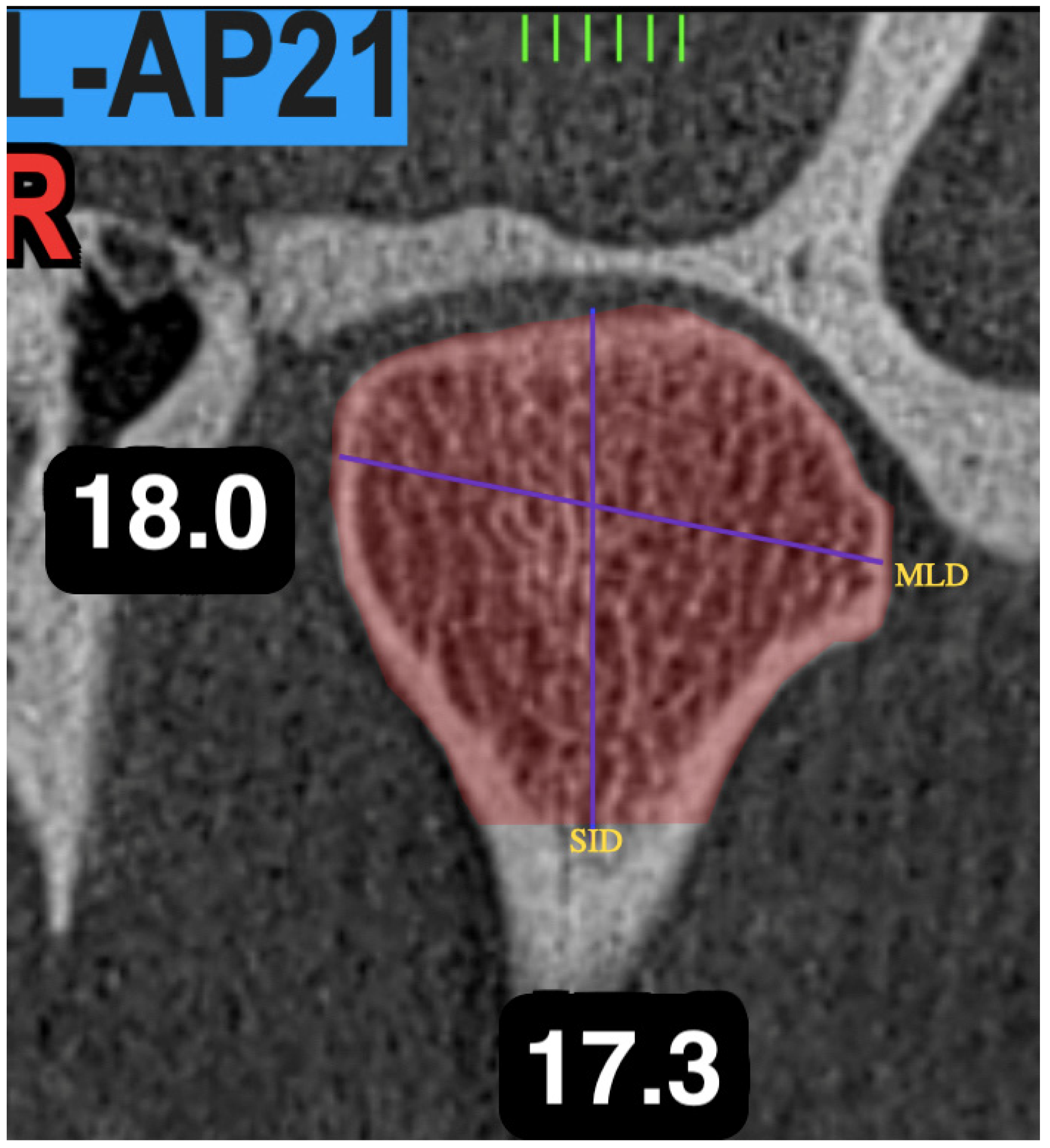Jcm 11 03631 g004 Jcm 11 03631 g004