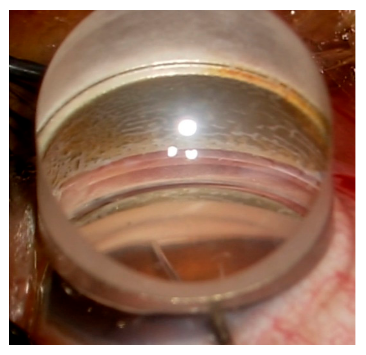 Jcm 11 03768 g001 550