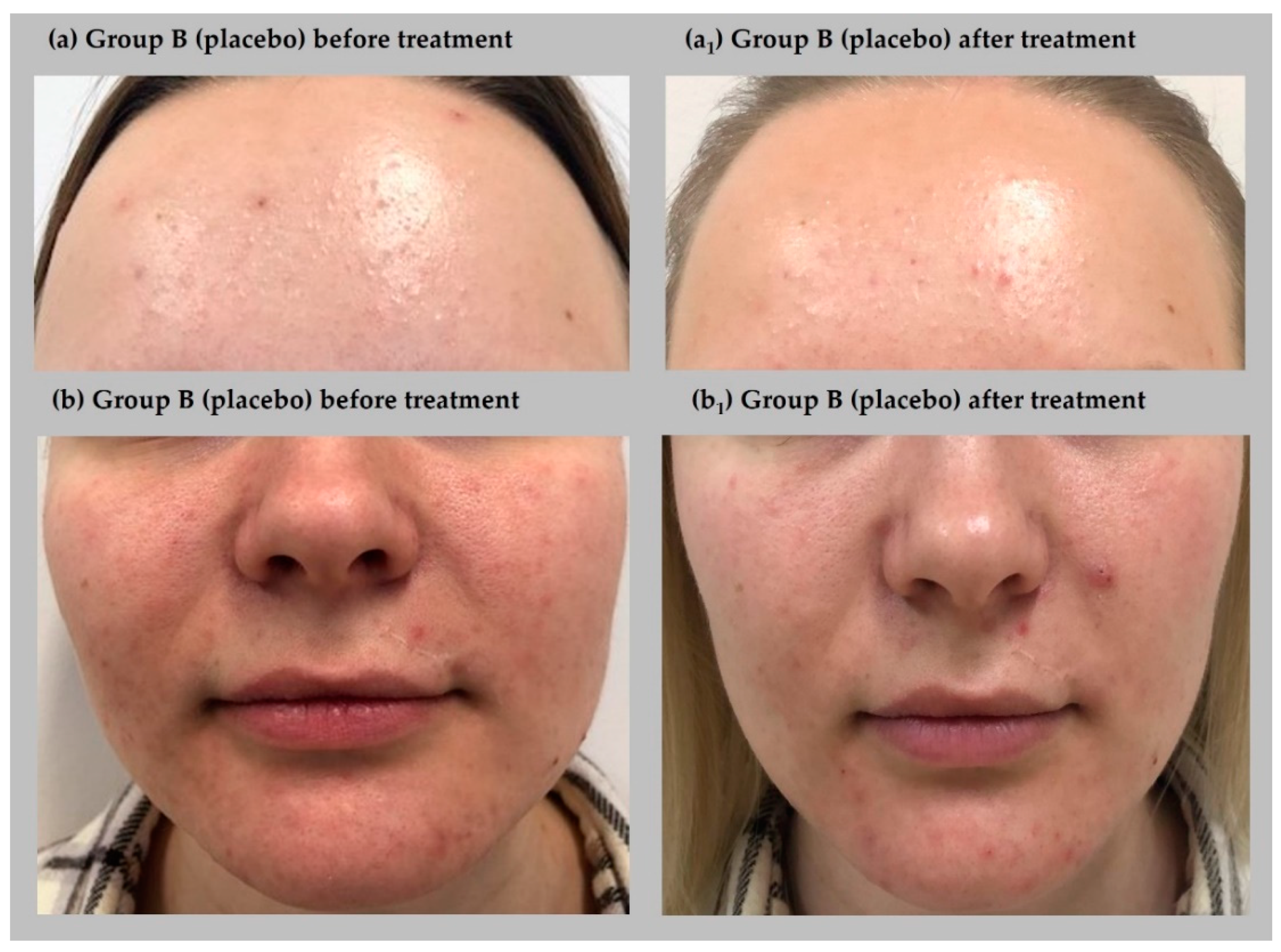 Jcm 11 03824 g003 550