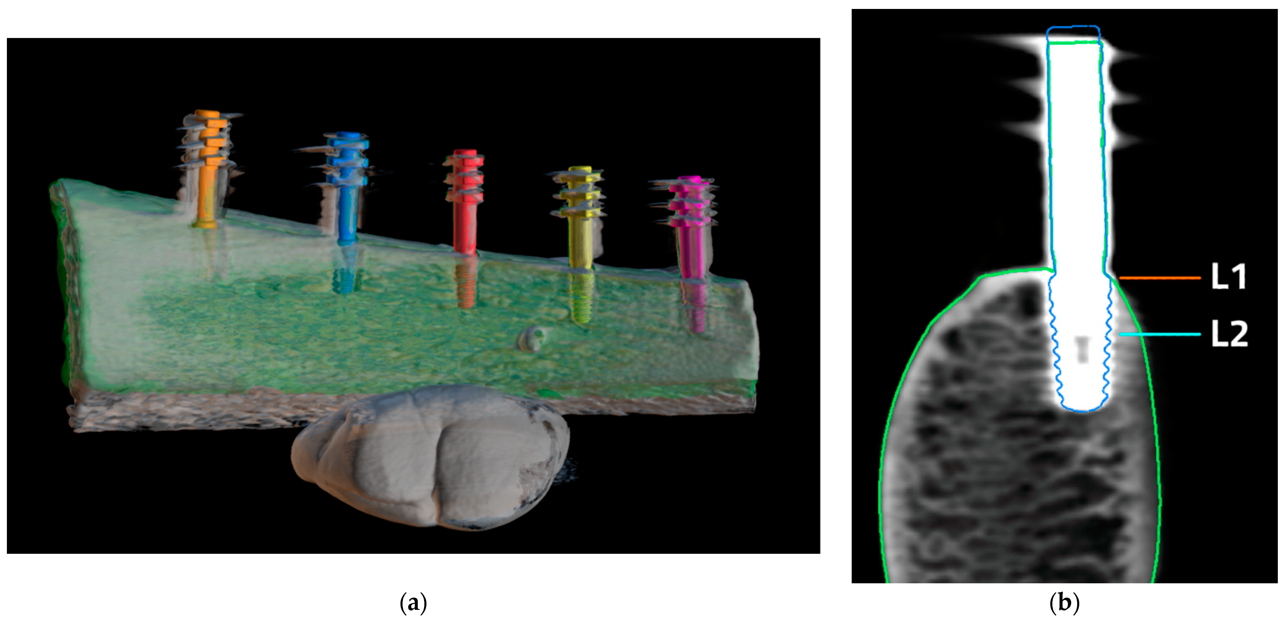 Jcm 11 03846 g003 Jcm 11 03846 g003