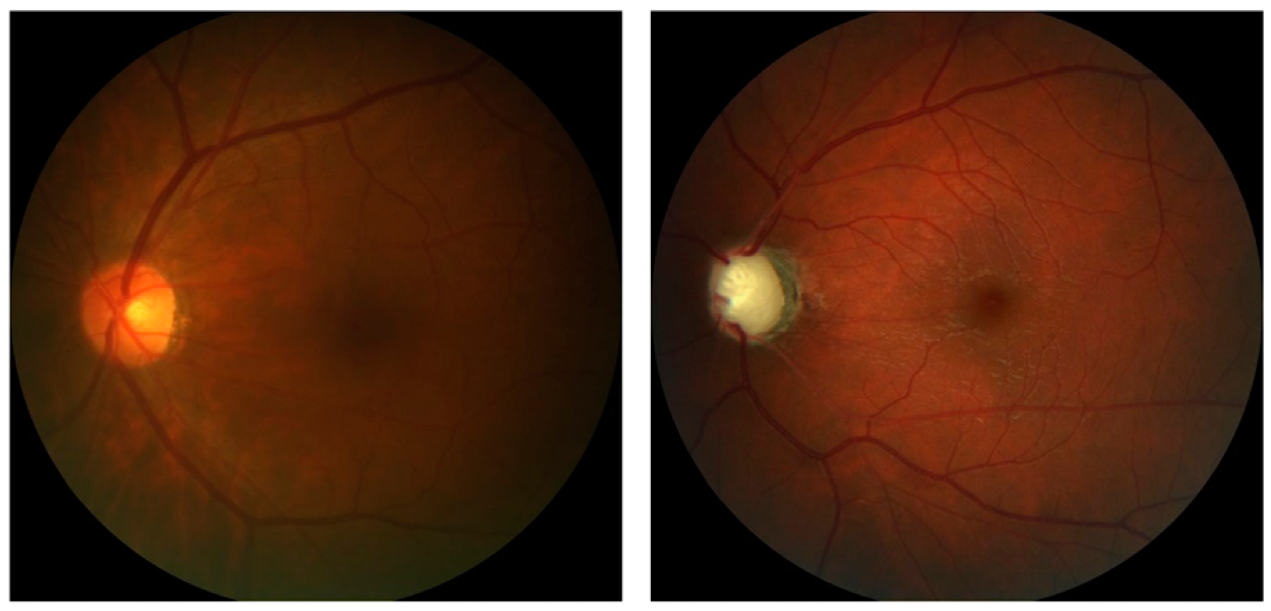 Jcm 11 03850 g004 550