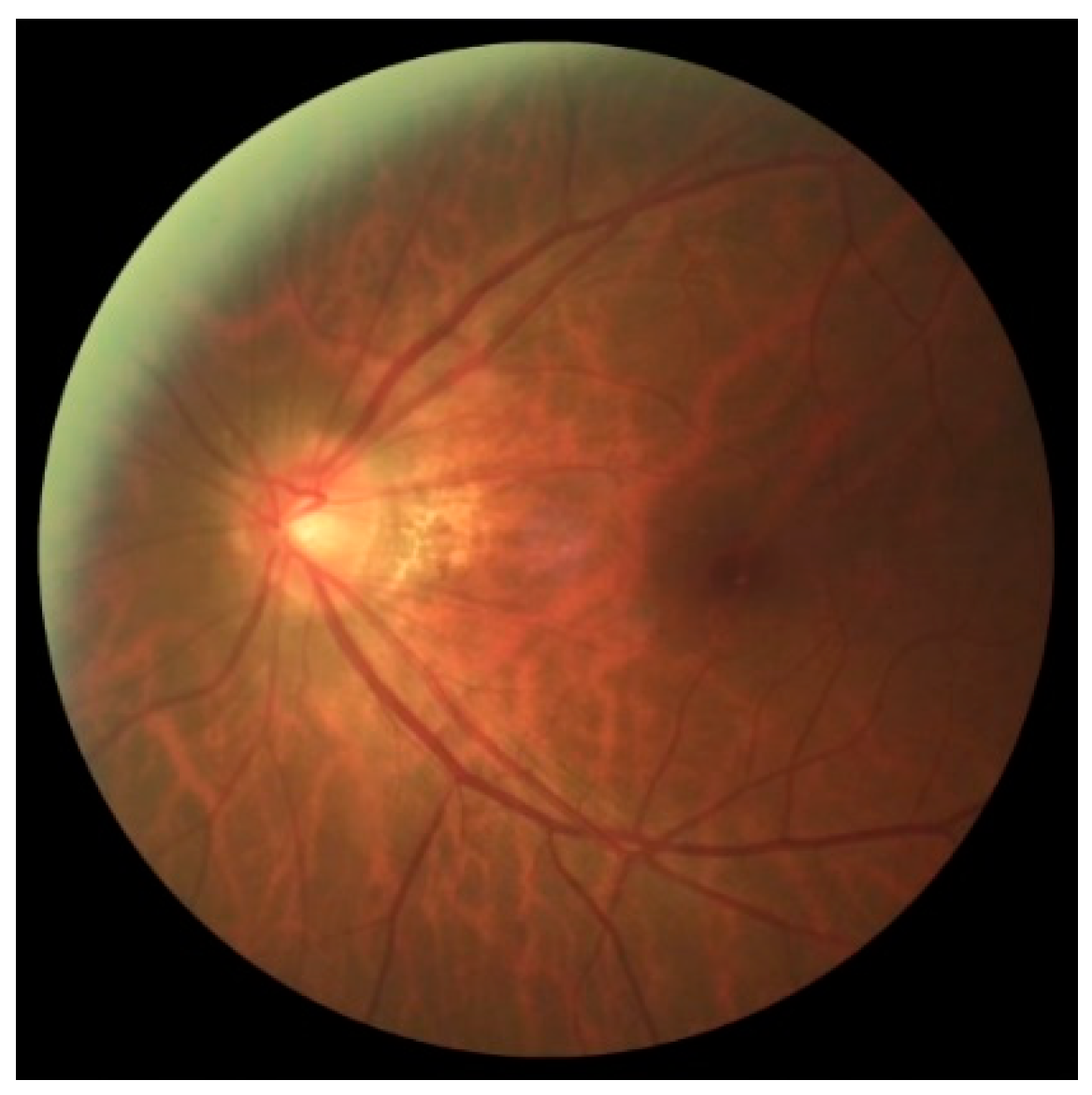 Jcm 11 03850 g005 550