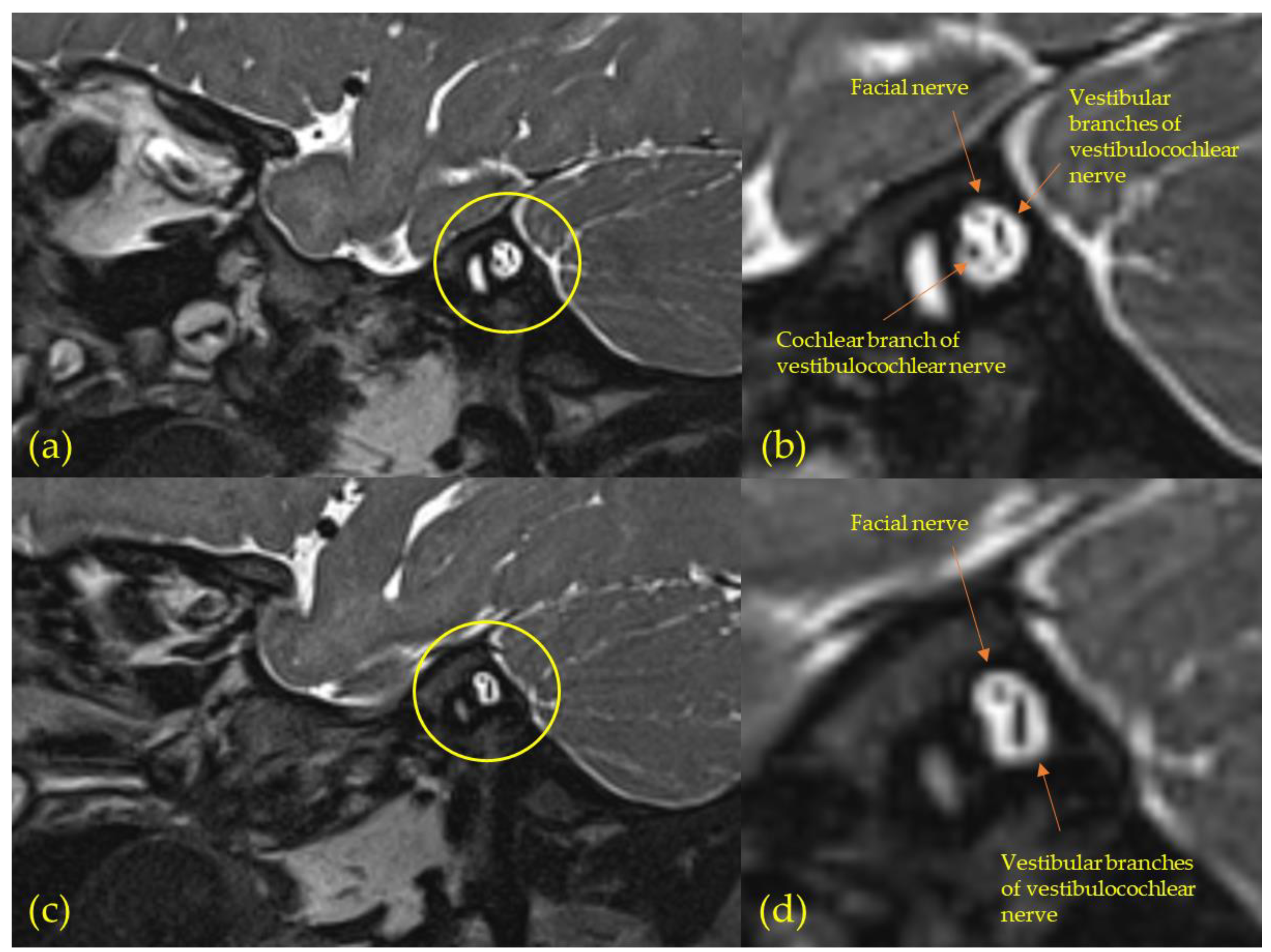 Jcm 11 03966 g004 550