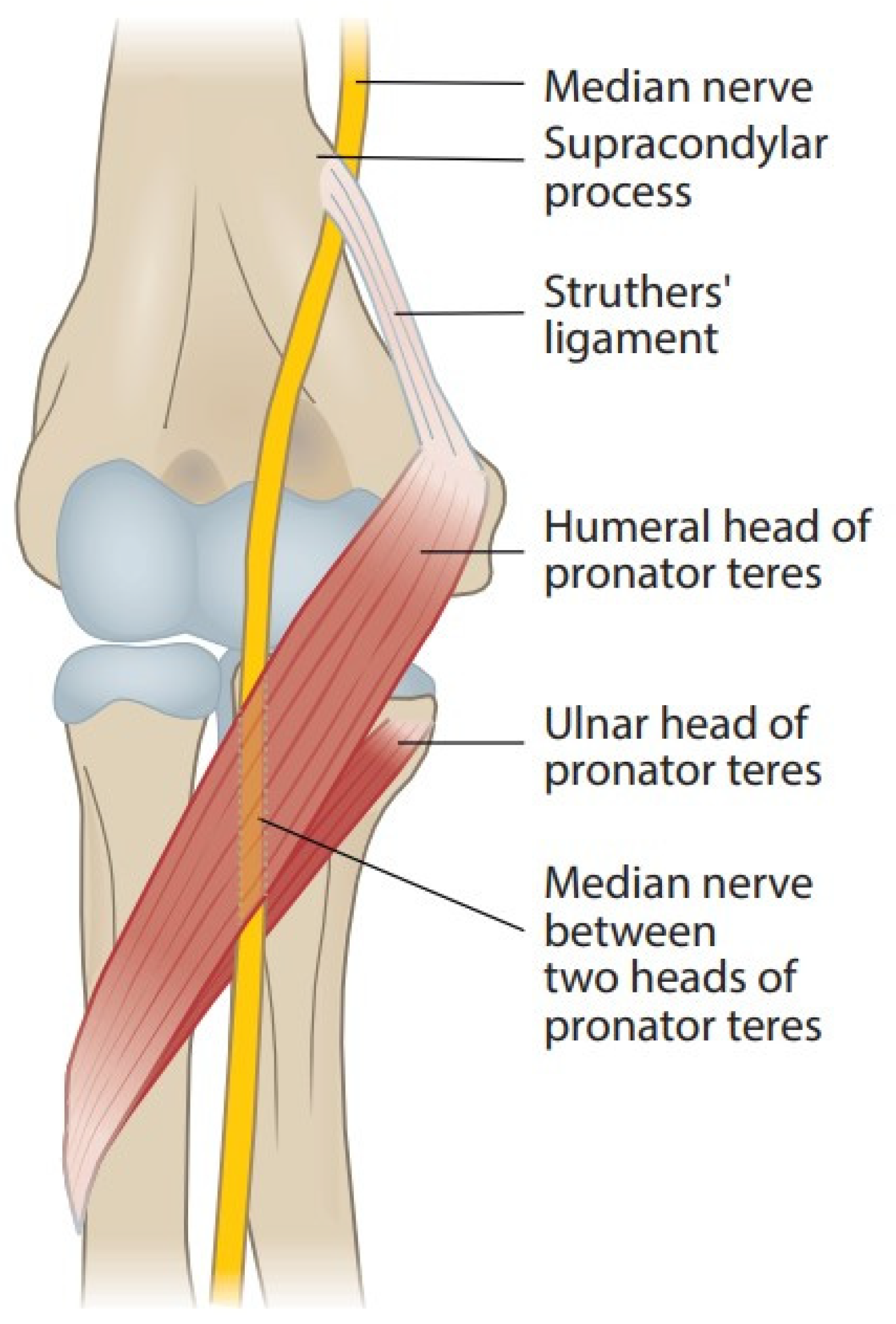 Ulnar Neuropathy Treatment in NYC