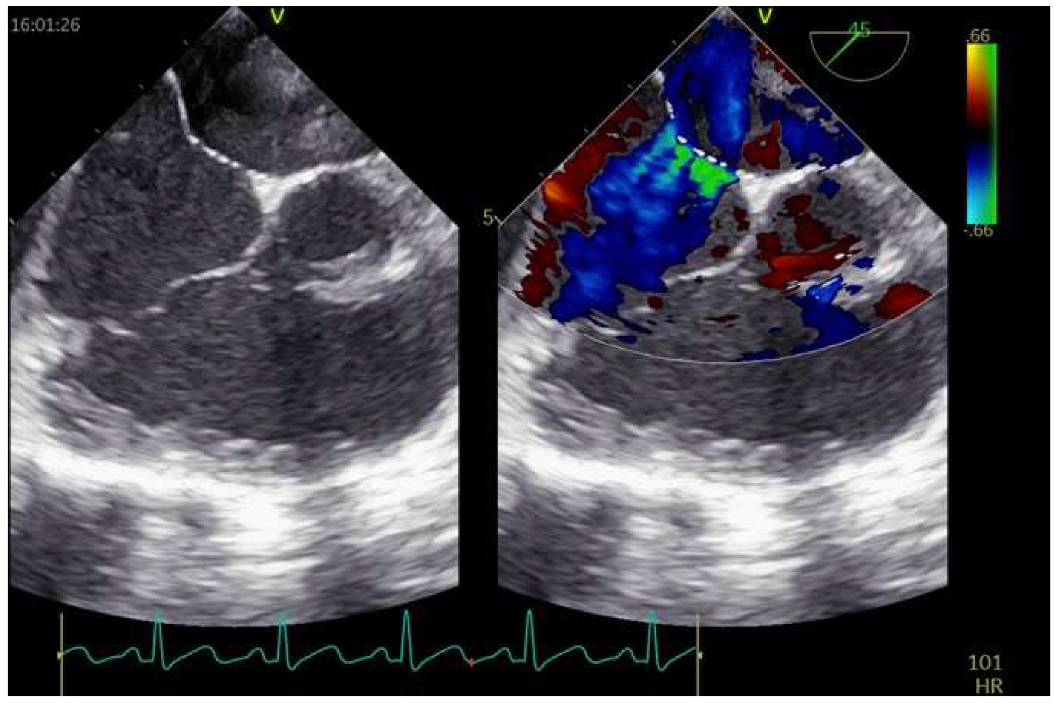 Jcm 11 04001 g005 Jcm 11 04001 g005