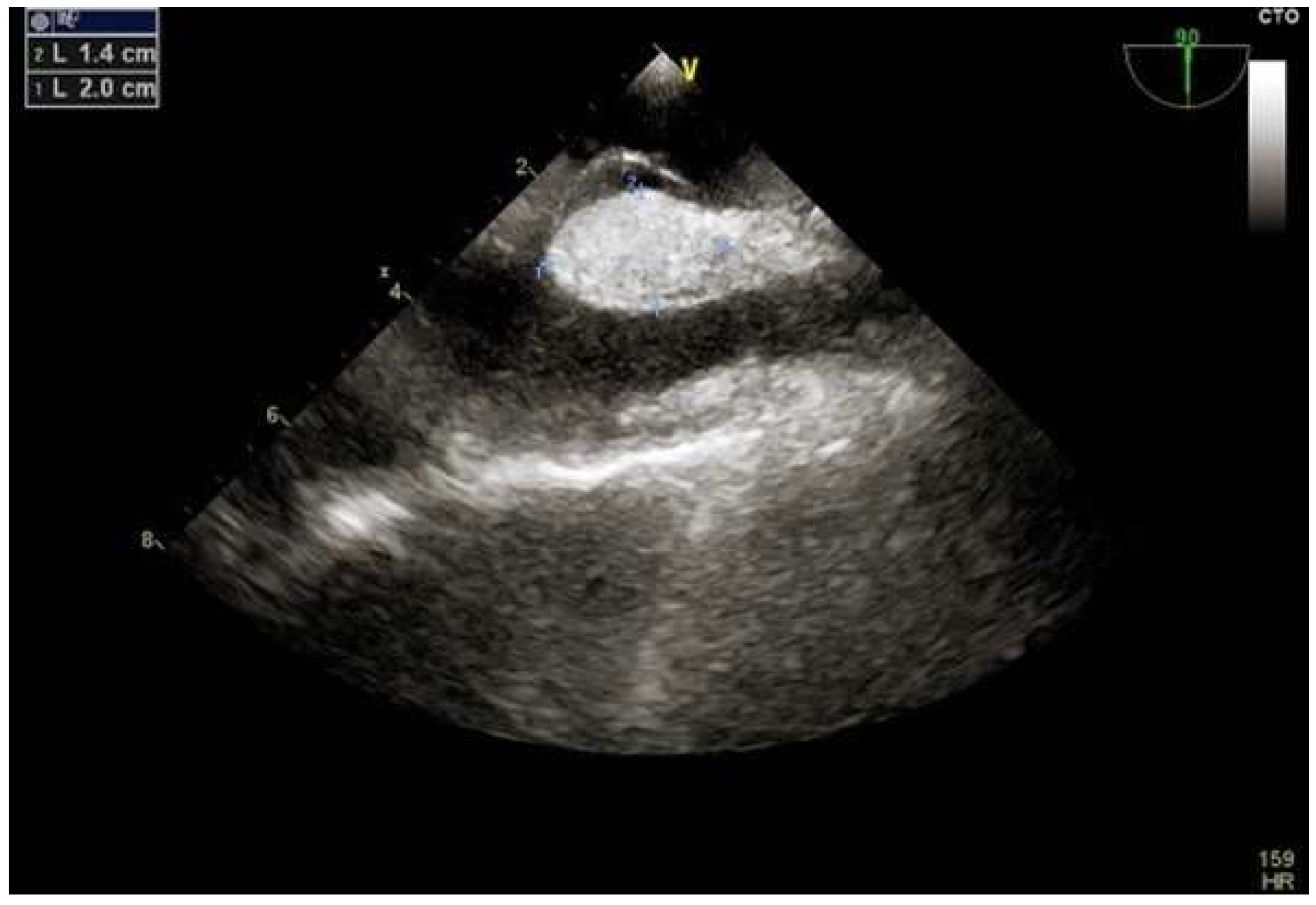 Jcm 11 04001 g008 Jcm 11 04001 g008