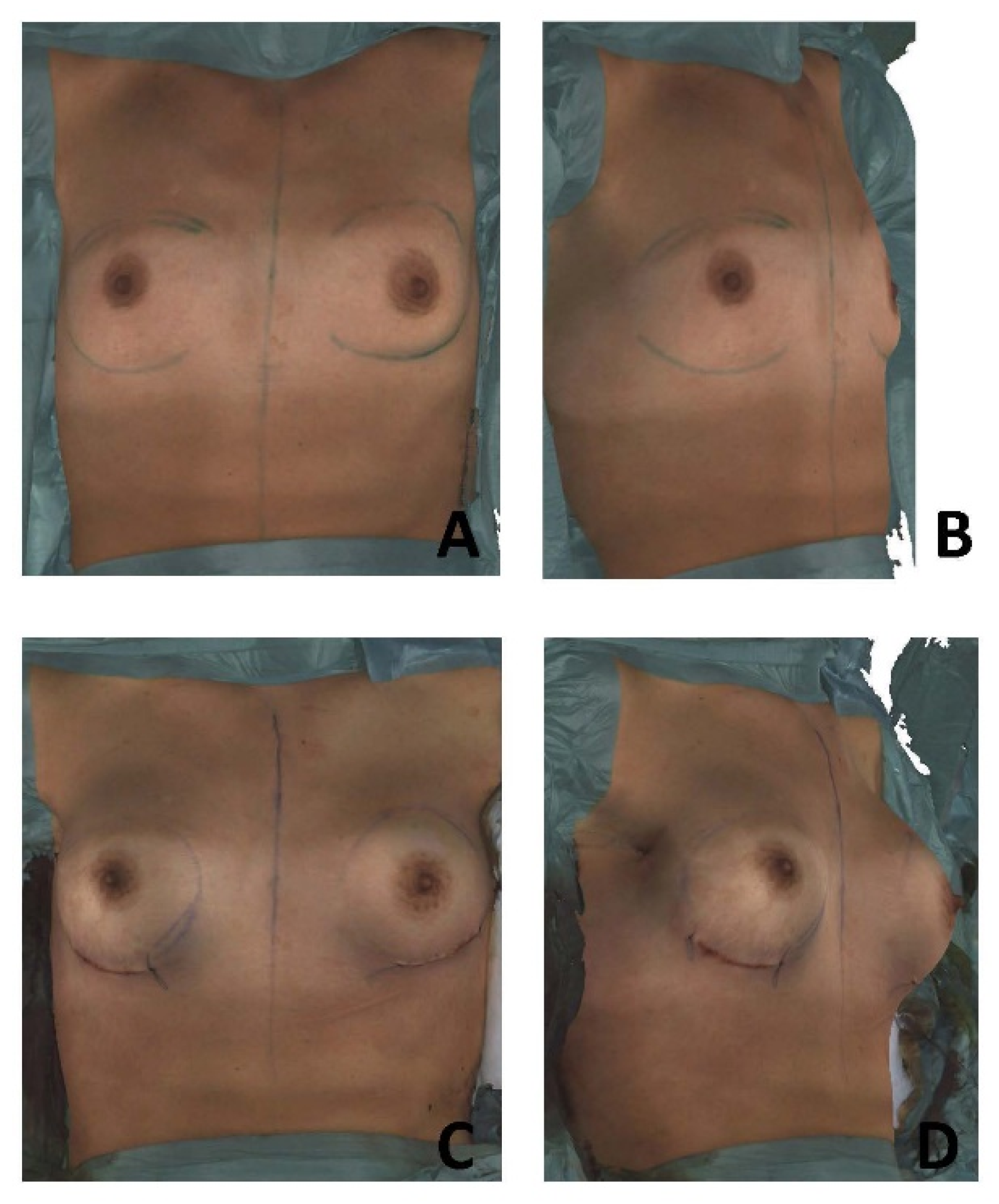 Jcm 11 04002 g002 Jcm 11 04002 g002