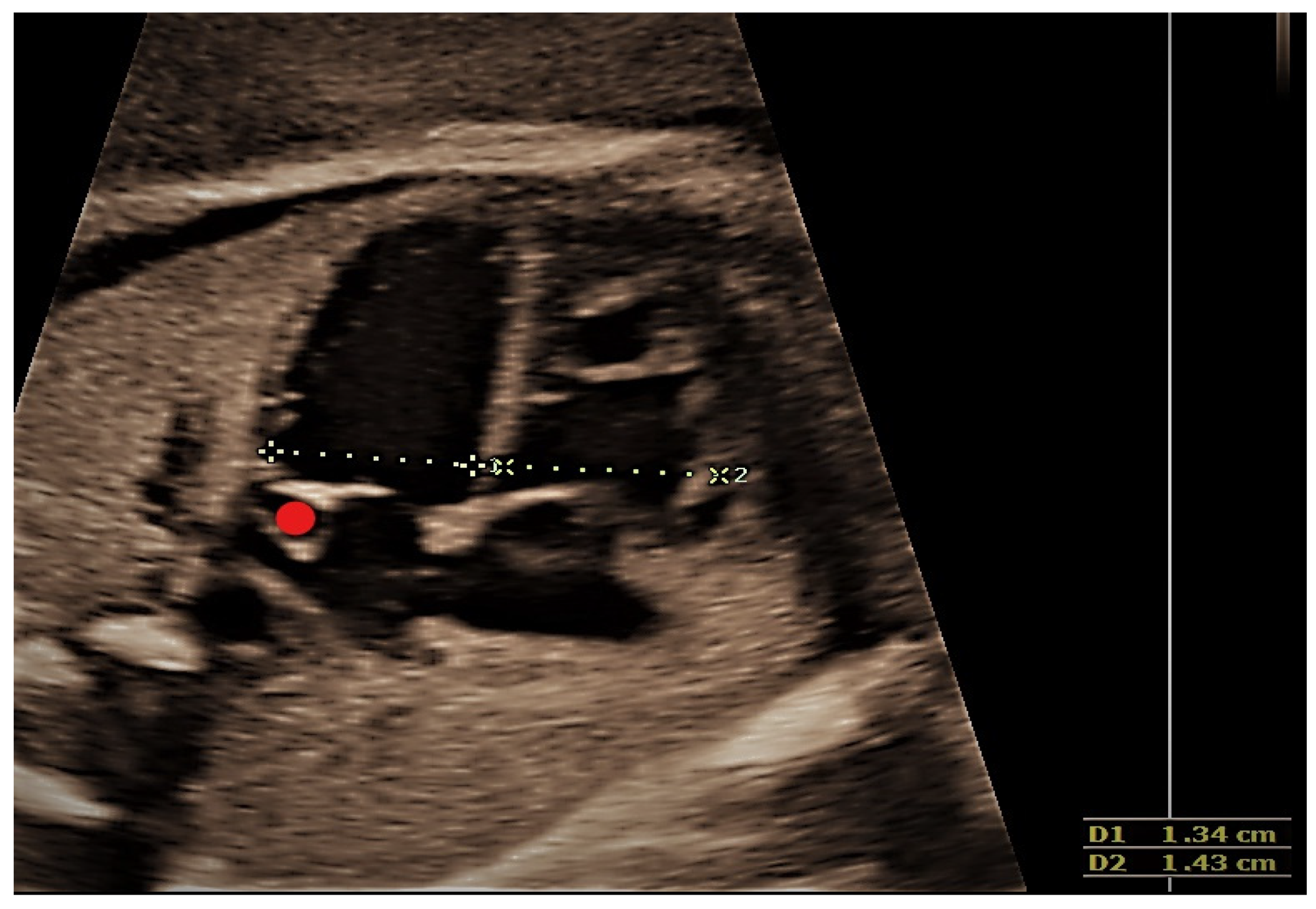 Jcm 11 04020 g003 Jcm 11 04020 g003