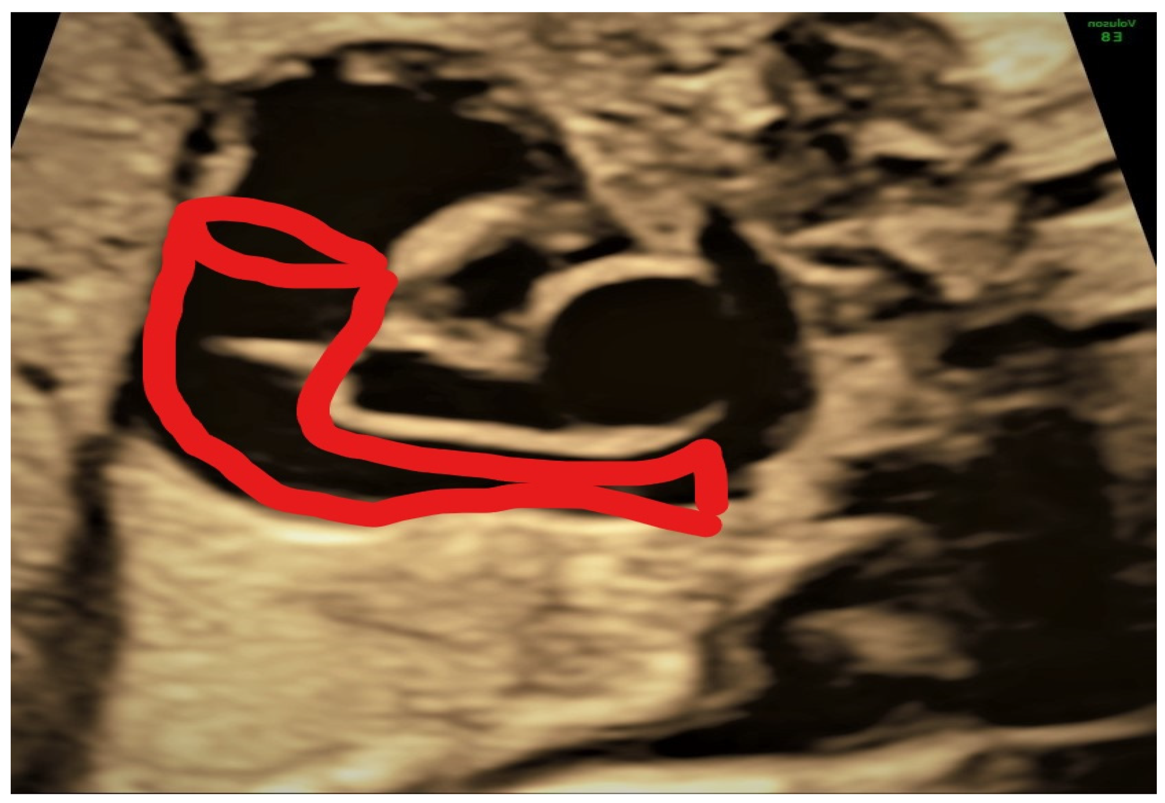 Jcm 11 04020 g004 Jcm 11 04020 g004