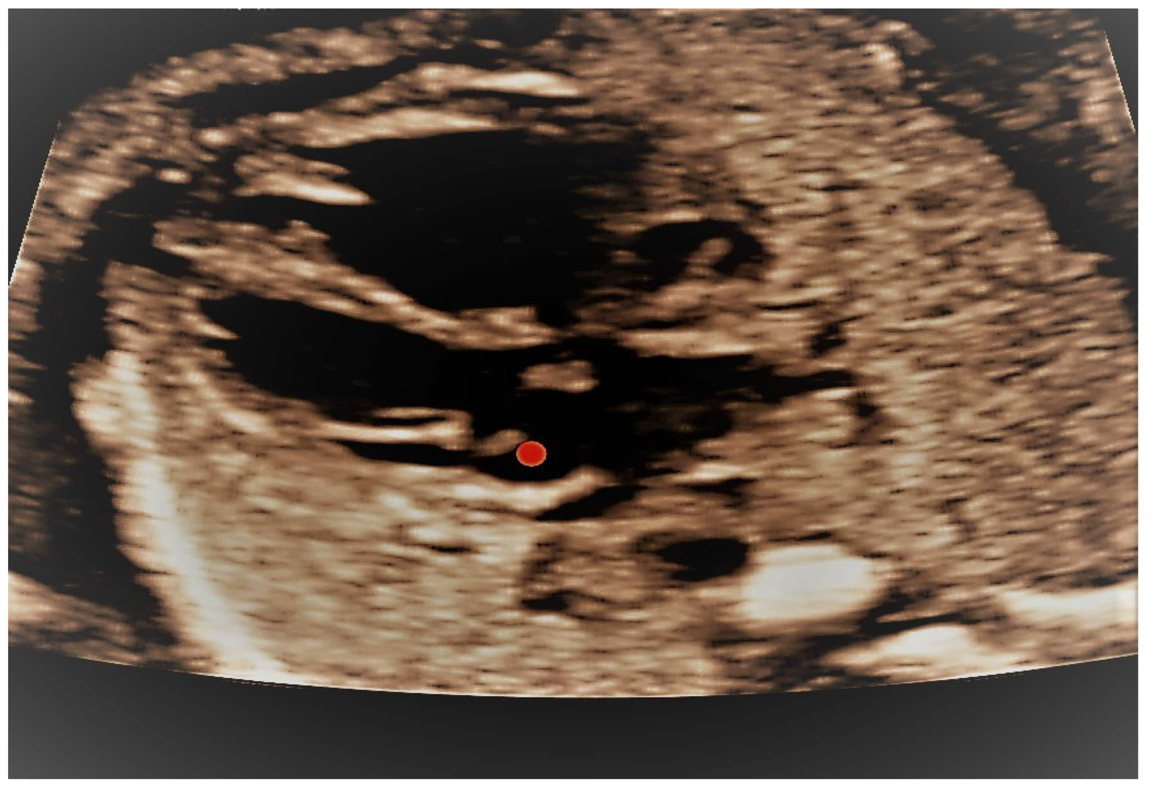 Jcm 11 04020 g007 Jcm 11 04020 g007