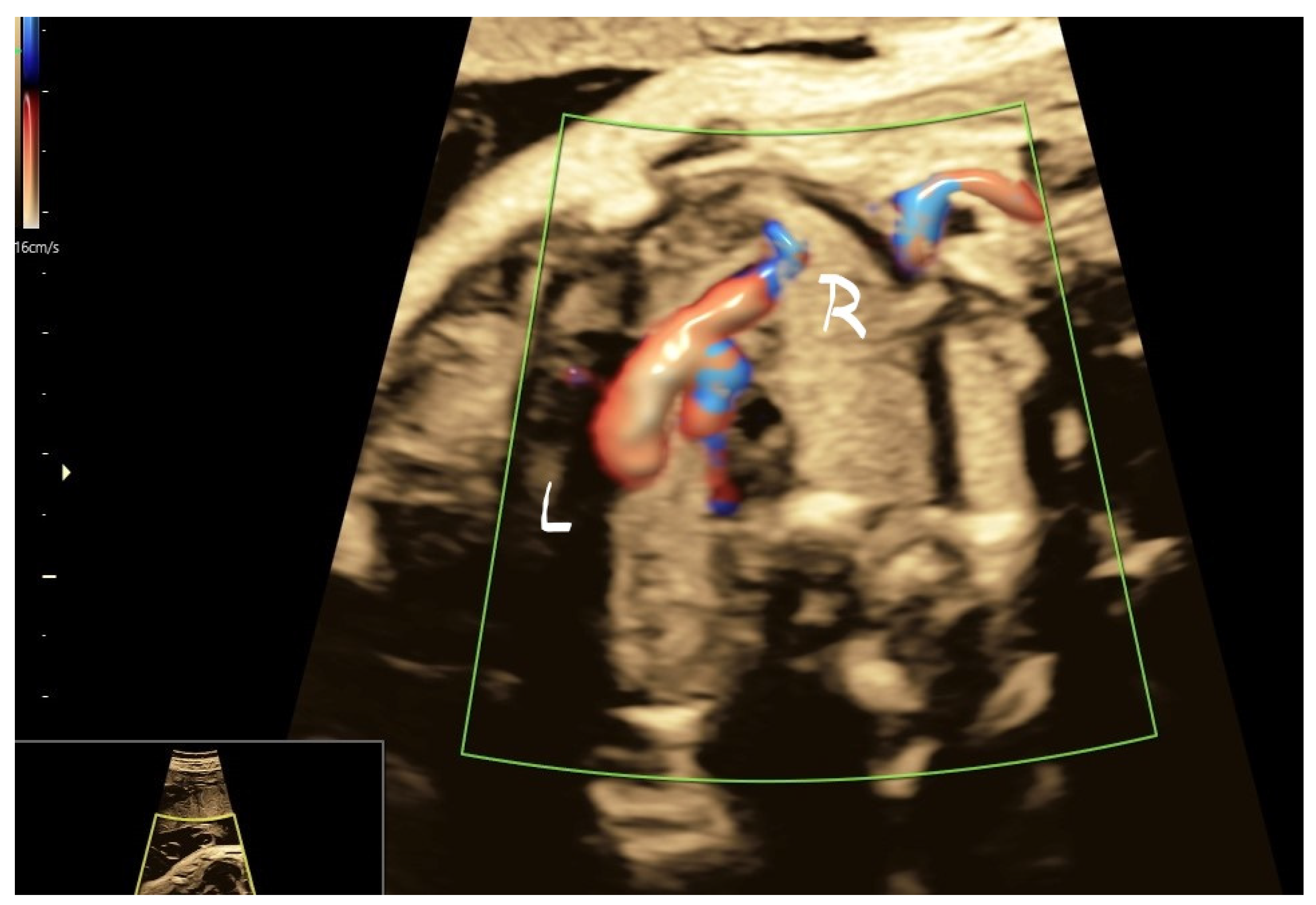 Jcm 11 04020 g008 Jcm 11 04020 g008