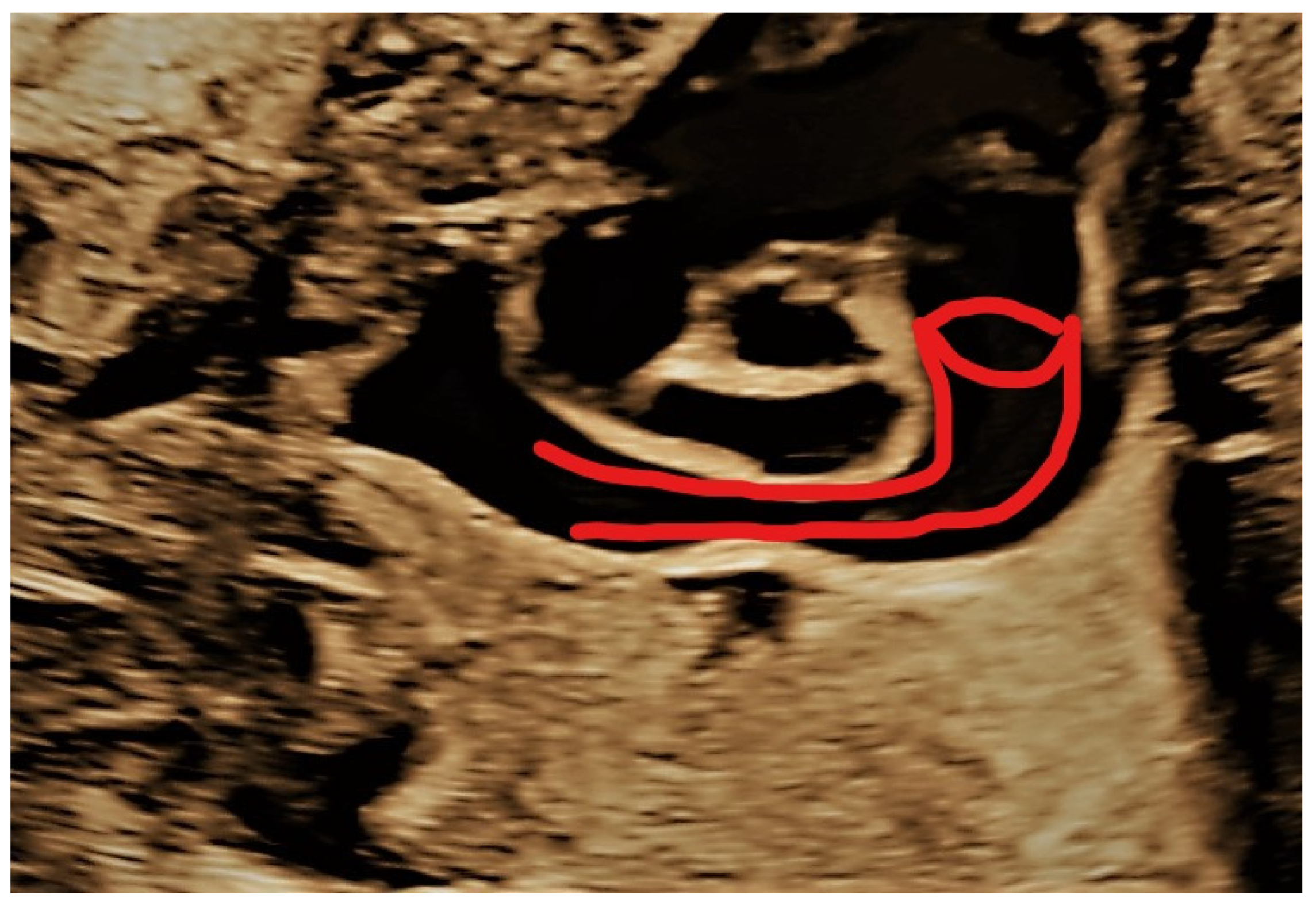 Jcm 11 04020 g009 Jcm 11 04020 g009