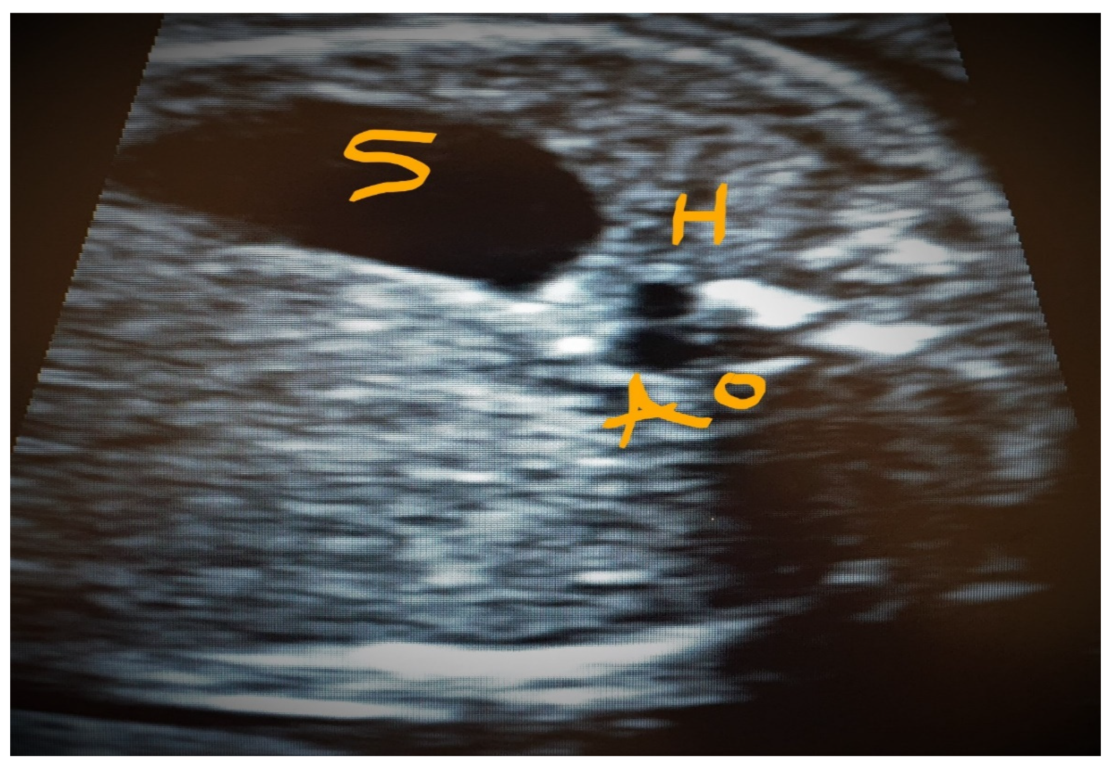 Jcm 11 04020 g010 Jcm 11 04020 g010