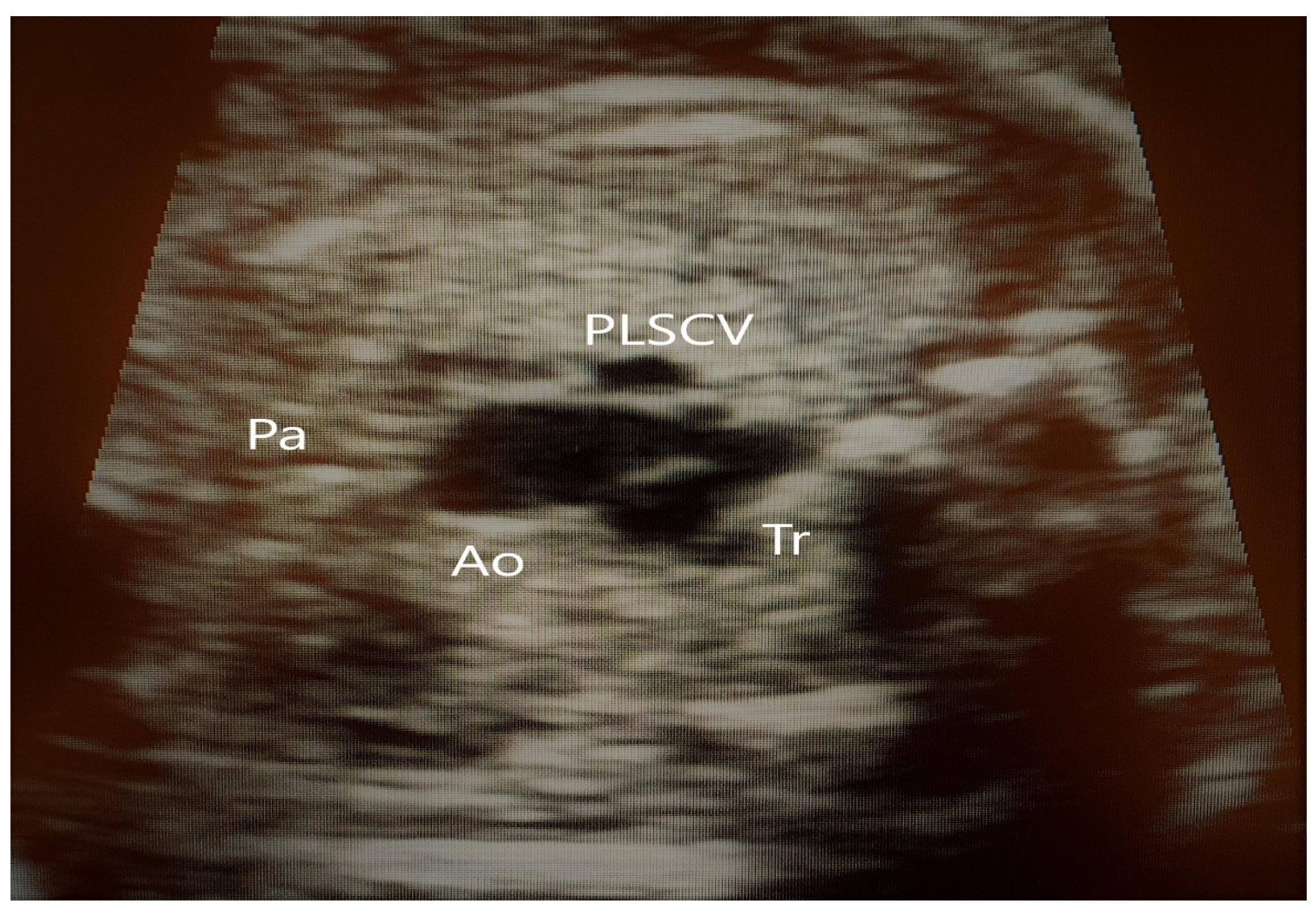 Jcm 11 04020 g011 Jcm 11 04020 g011