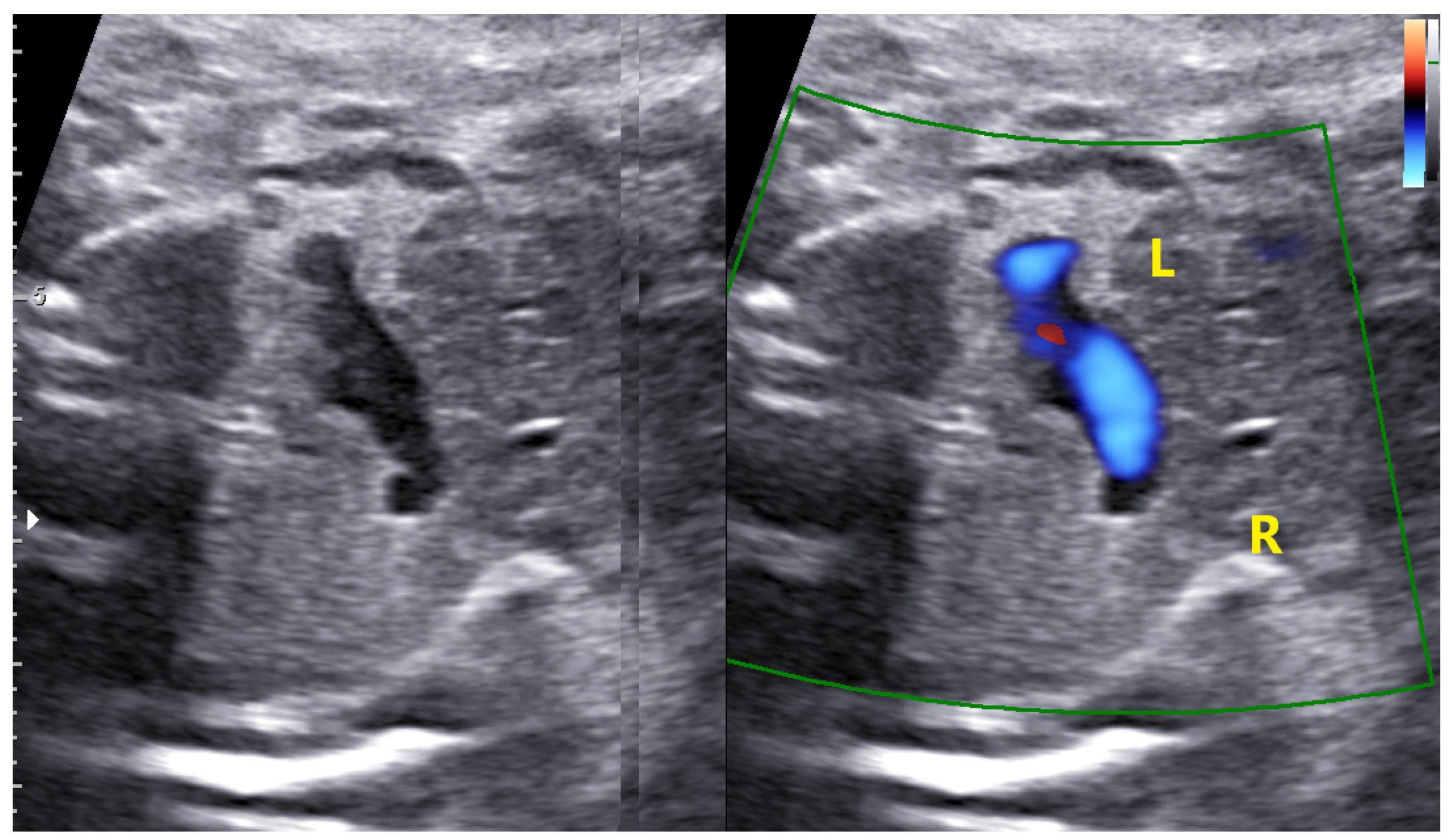Jcm 11 04020 g015 Jcm 11 04020 g015