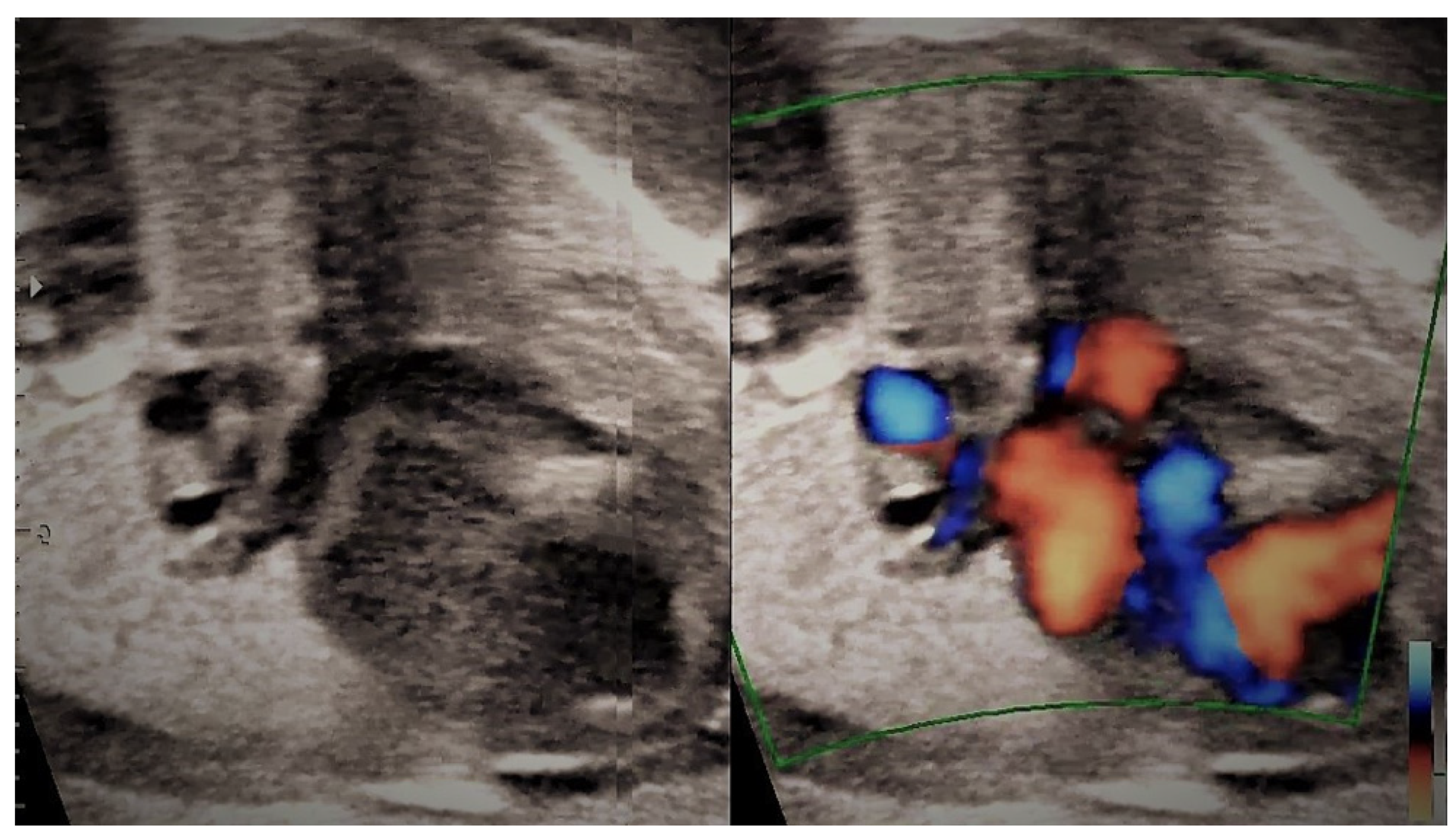 Jcm 11 04020 g016 Jcm 11 04020 g016
